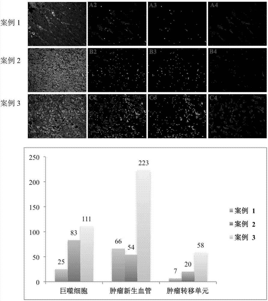 Tumor metastasis unit counting method based on quantum dot spectrum analysis and image parsing