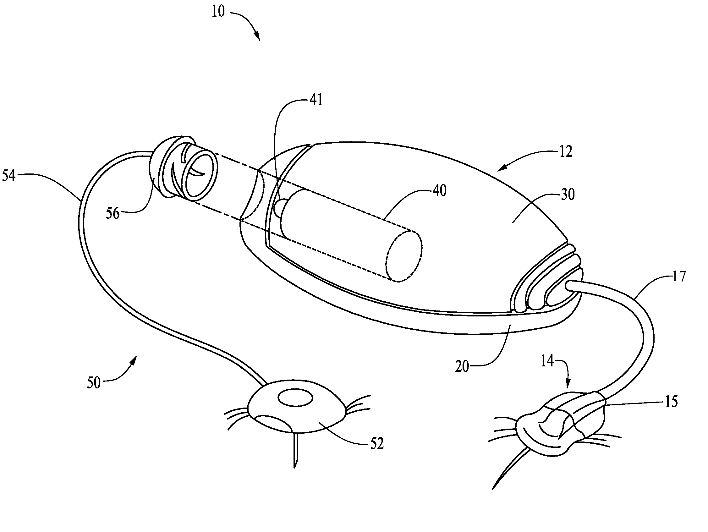 Alignment systems and methods