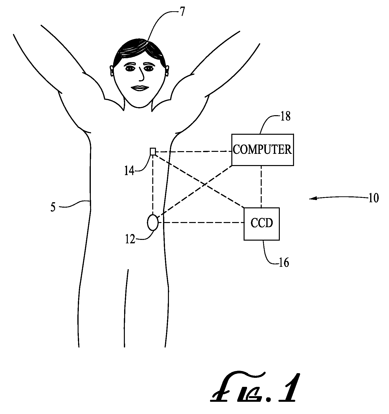 Alignment systems and methods