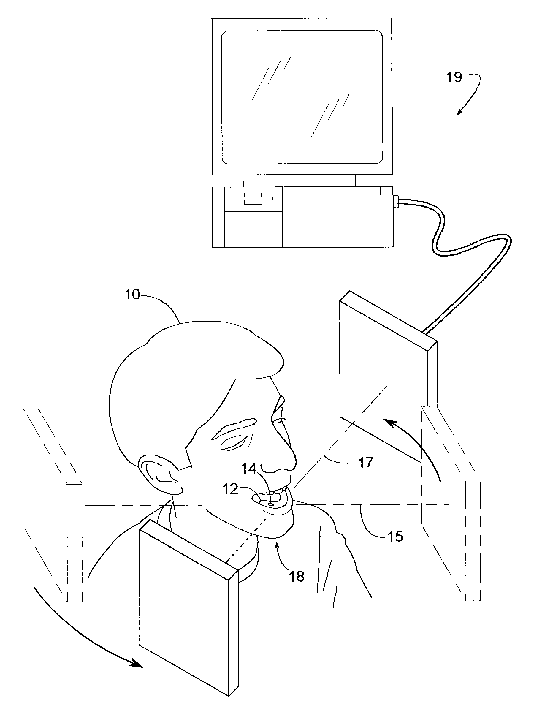 Method of adjusting a drill bushing for a dental implant