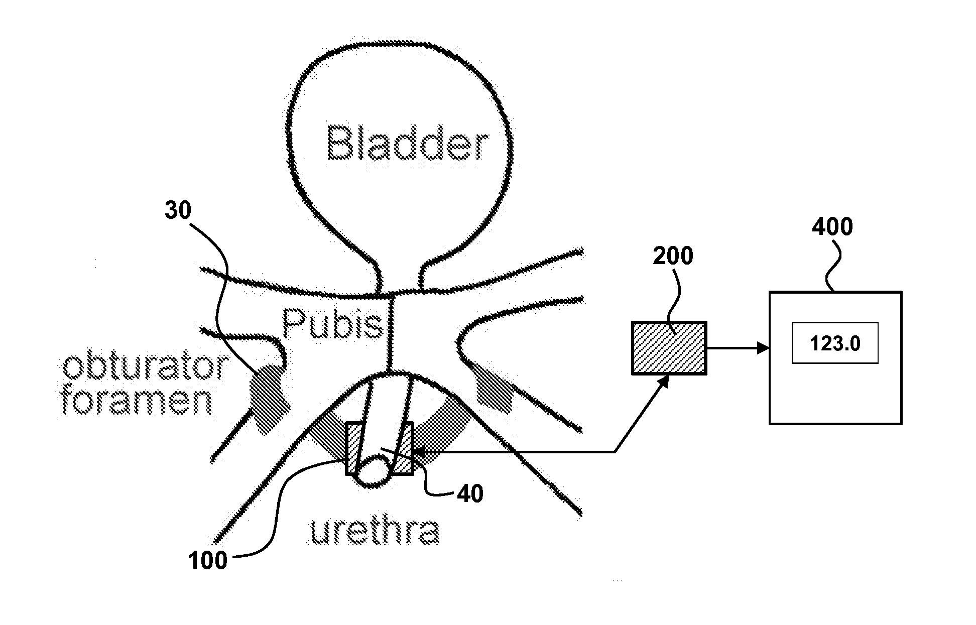 Device and method for measuring pressure exerted on a surface