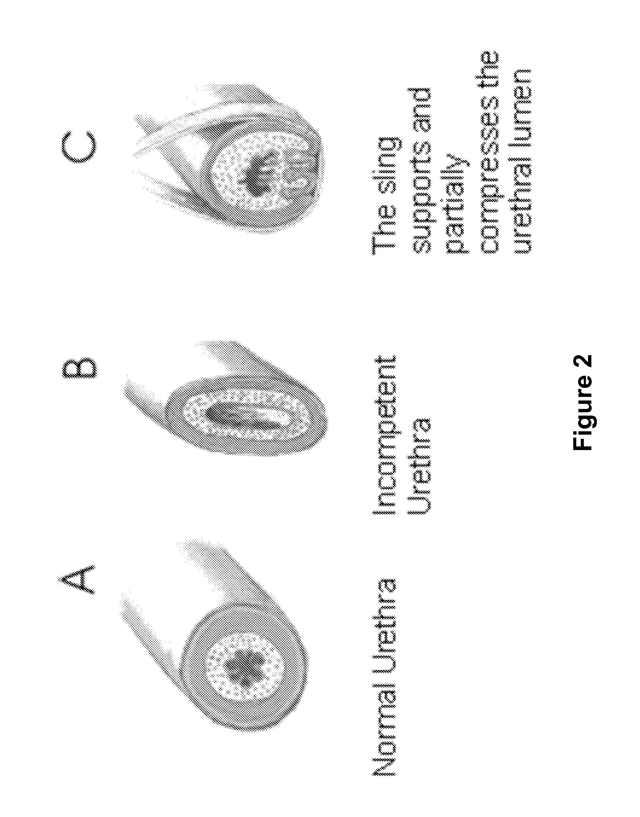 Device and method for measuring pressure exerted on a surface