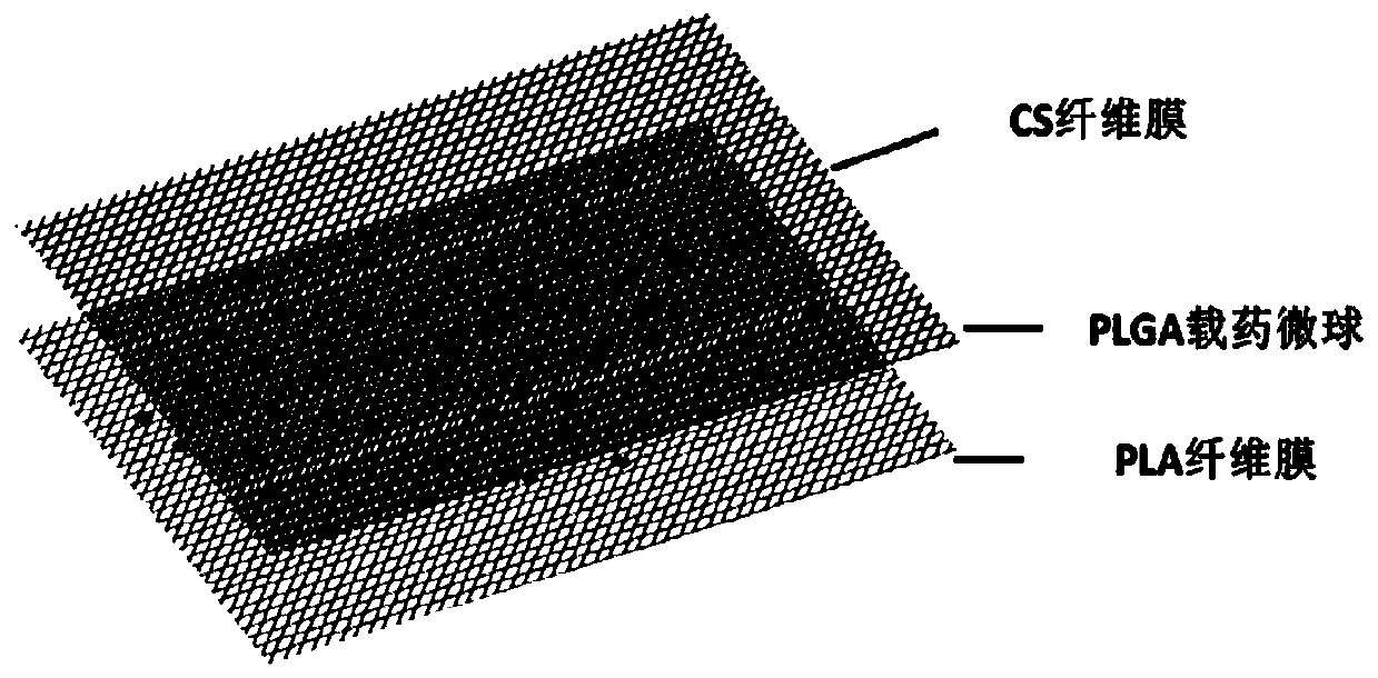 Composite membrane carrying bioactive factors PLA/PLGA/CS and preparation method thereof