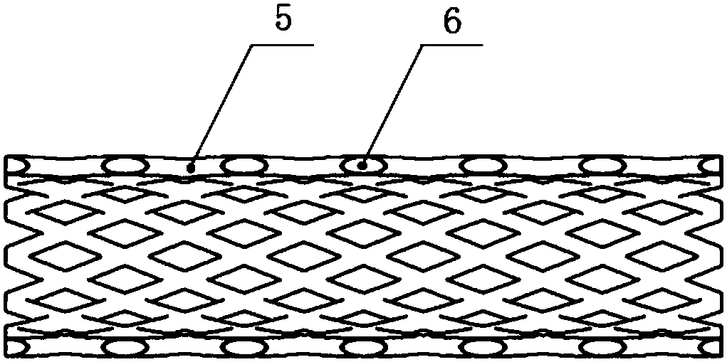 Recyclable heart stent