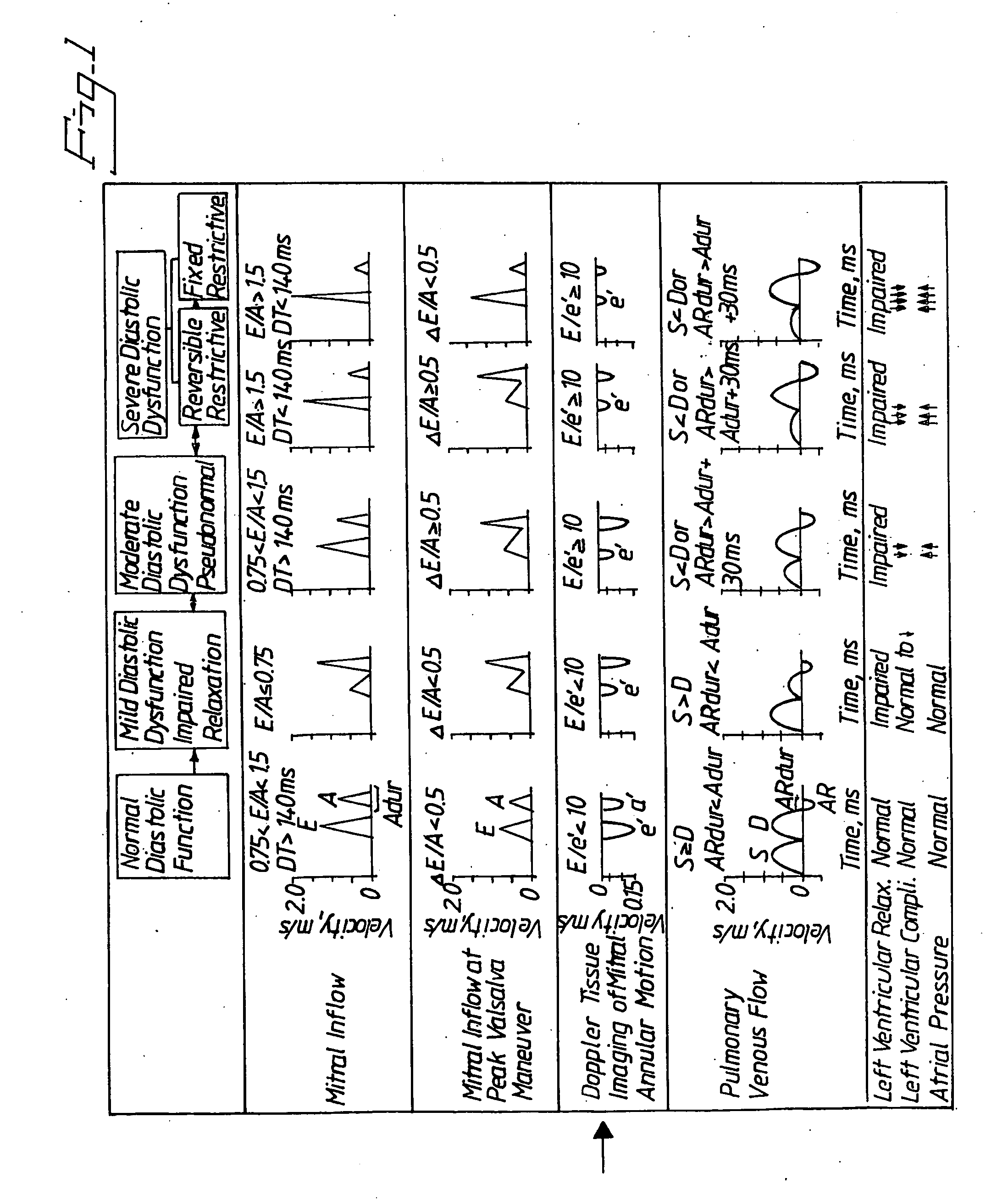 Apparatus and Method for Detecting Diastolic Heart Failure