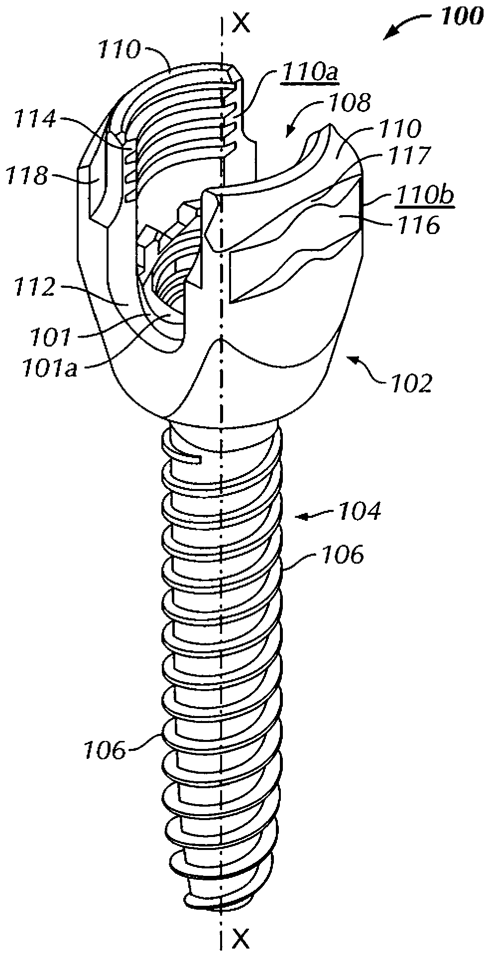 Spinal surgery instrument sets and methods