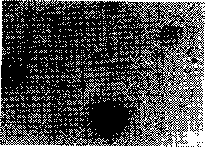 Neural stem cell preparation, preparing method thereof and use of same