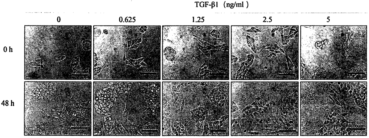 Suppression of EMT mediated liver cancer metastasis by Arteannuin B and action mechanism research thereof