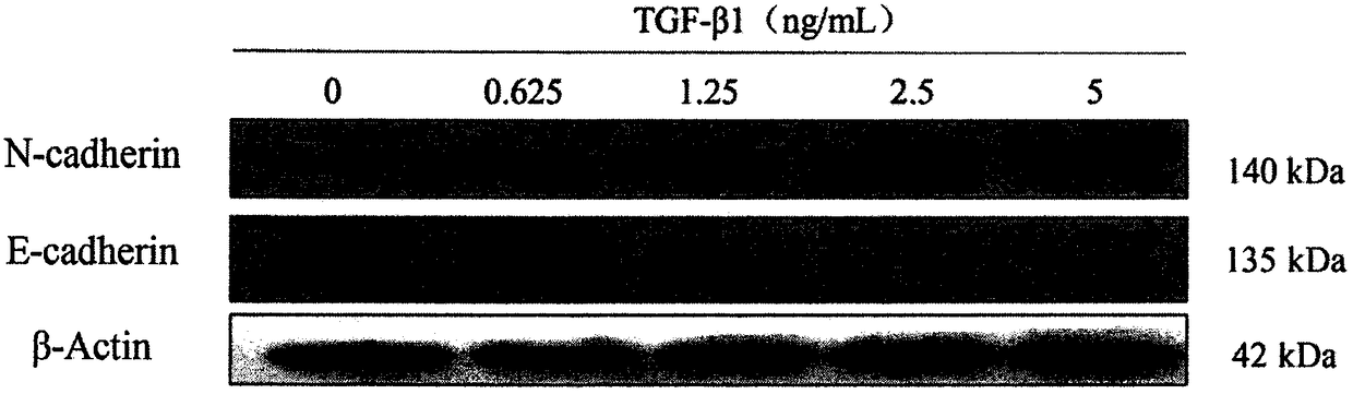 Suppression of EMT mediated liver cancer metastasis by Arteannuin B and action mechanism research thereof