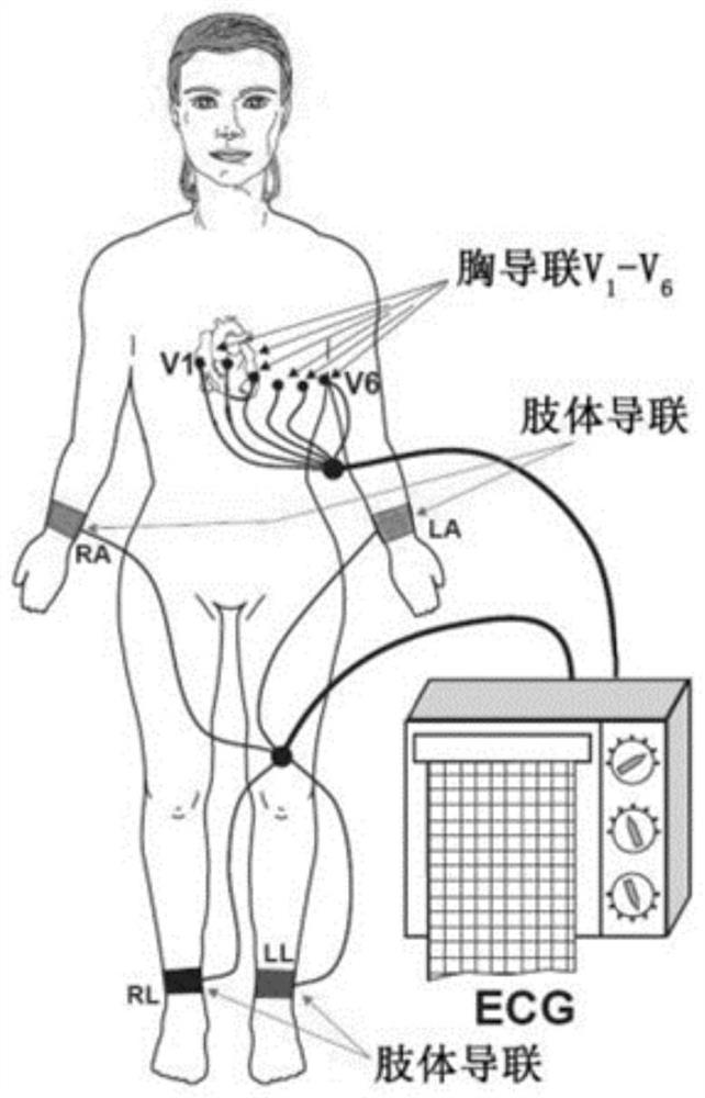 ST offset value calculation method and device, computer equipment and storage medium