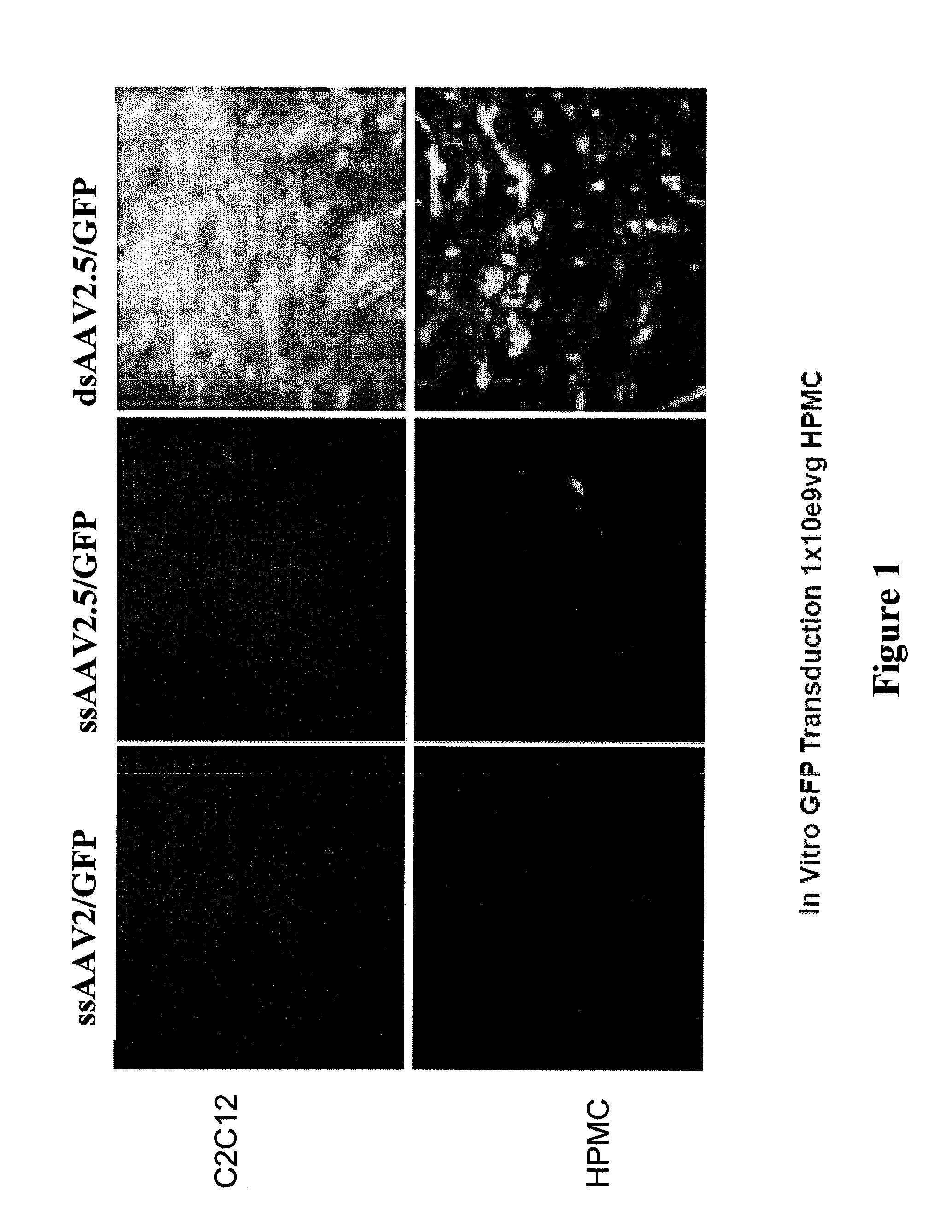 Modified factor VIII and factor IX genes and vectors for gene therapy