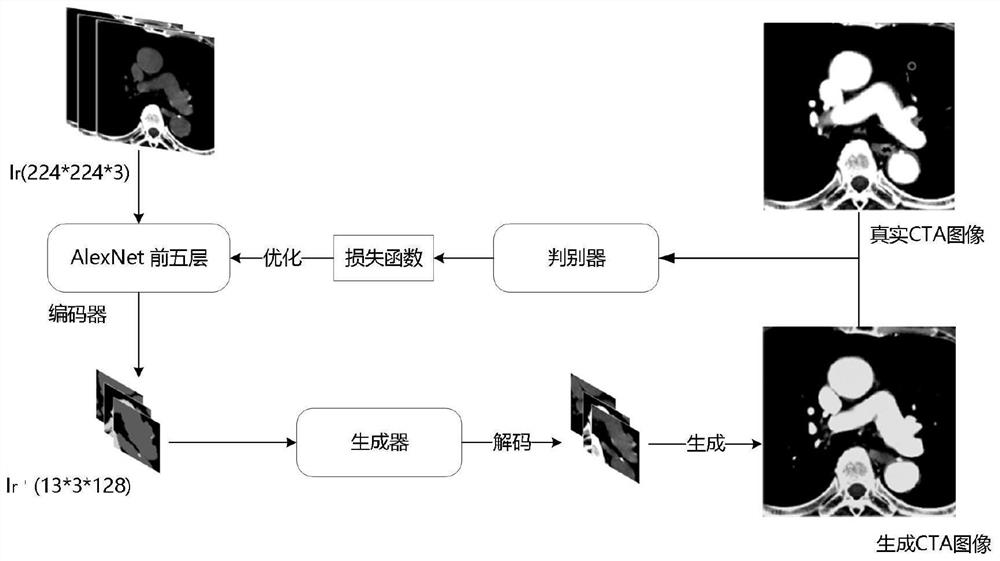 Deep learning-based CBCT image cross-modal prediction CTA image stroke risk screening method and system