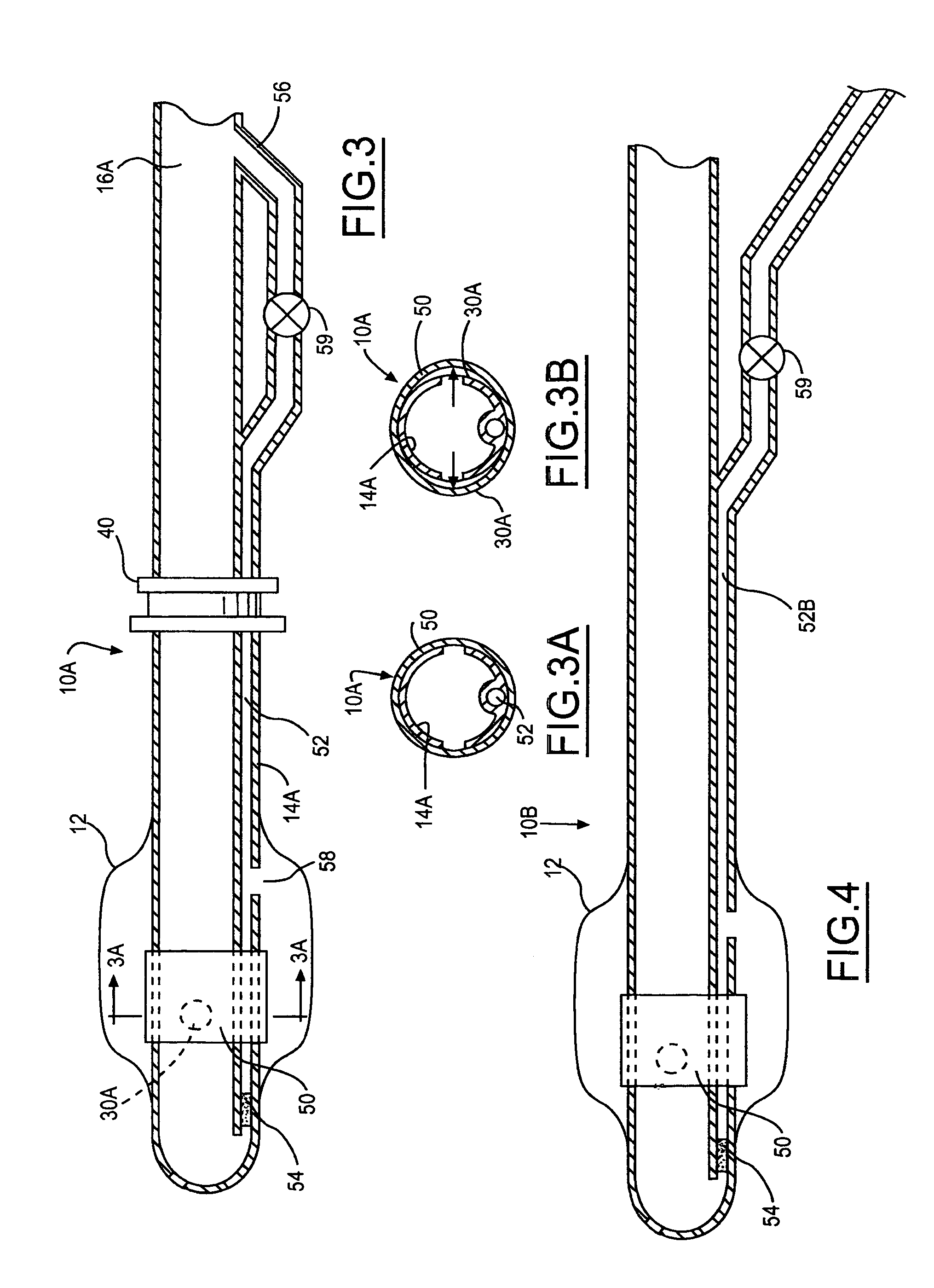 Retrograde cannula having automatically inflatable balloon