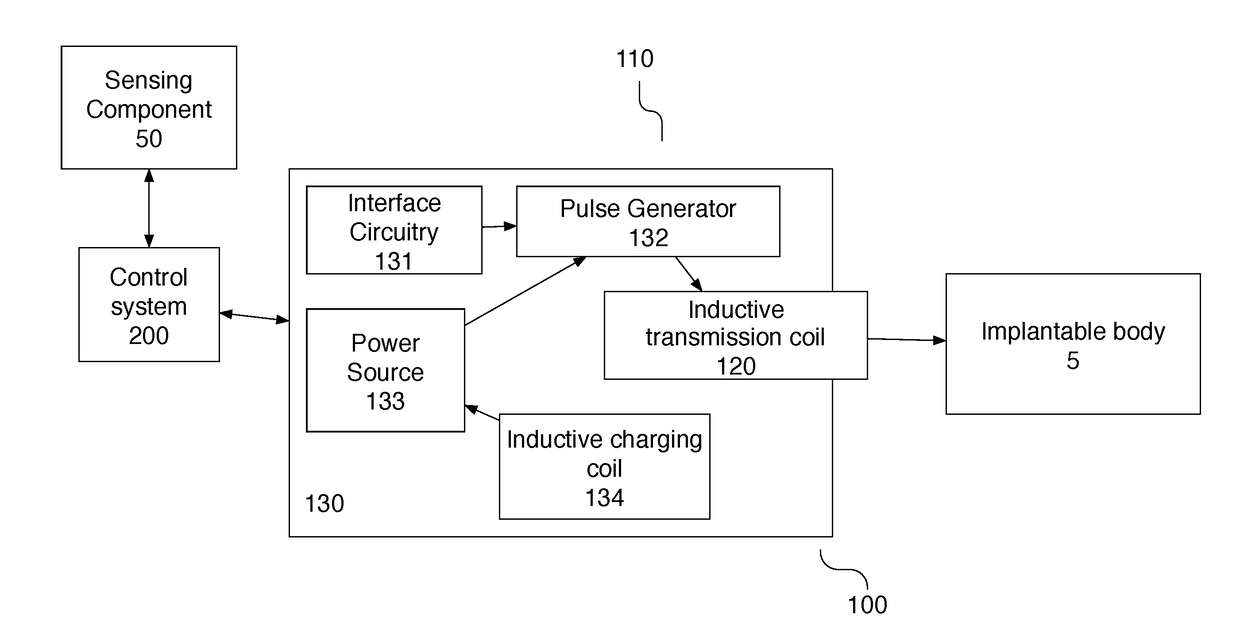 System and method for treating sleep apnea