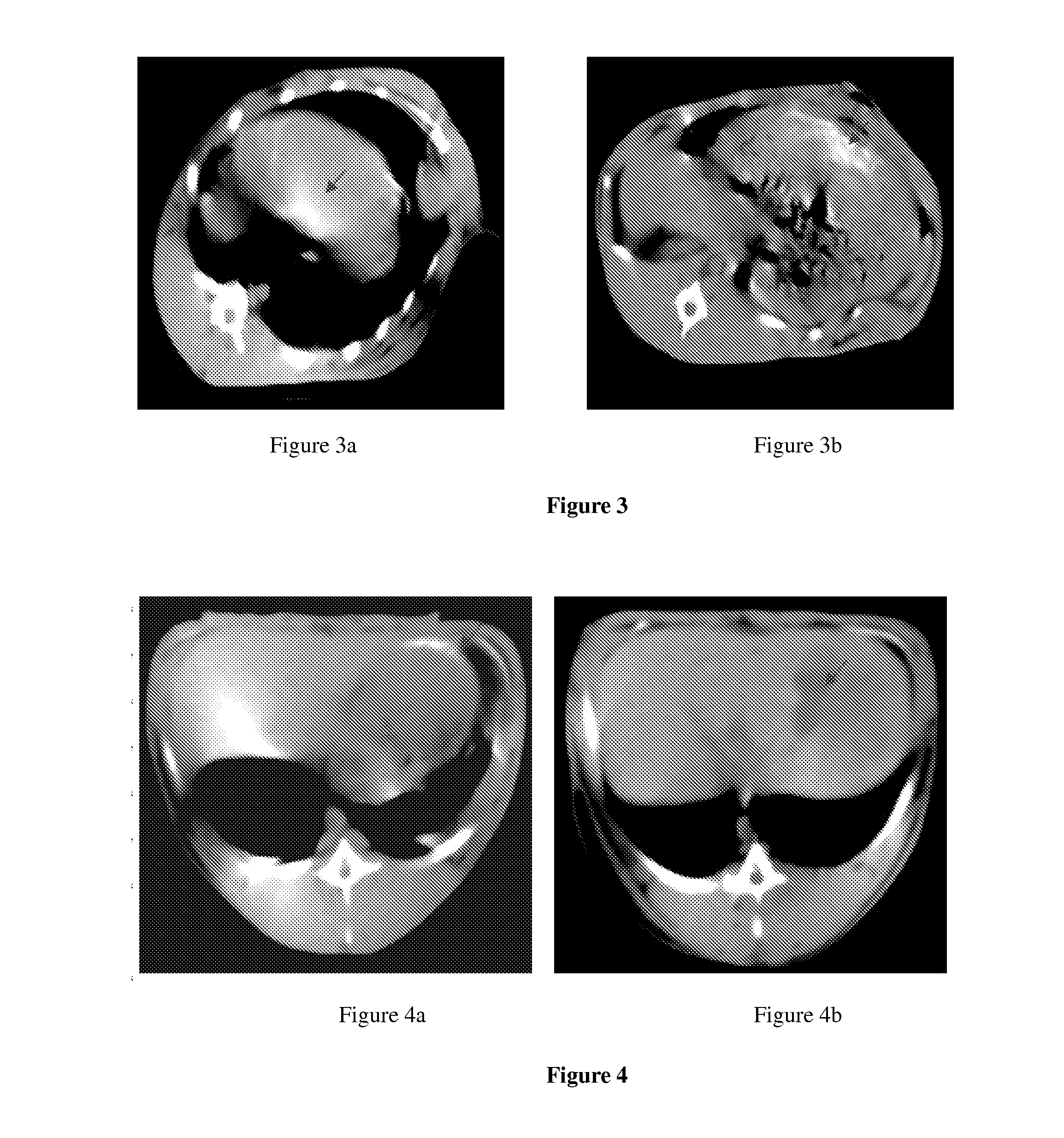 Vascular embolization gelling agent for sustained release of drugs for treating tumors and method for preparing the same