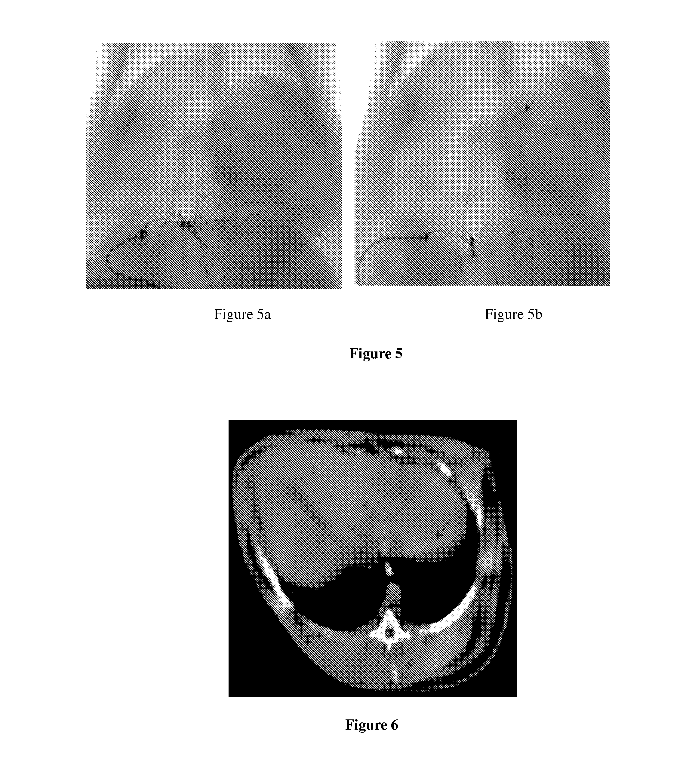 Vascular embolization gelling agent for sustained release of drugs for treating tumors and method for preparing the same