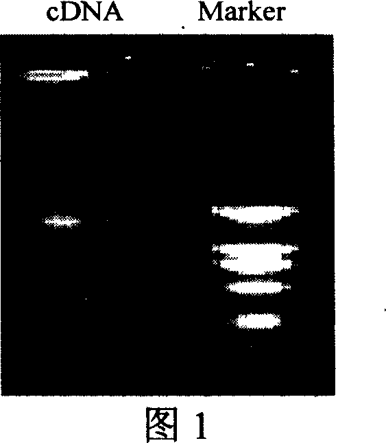 Human source anti-A botulinum neurotoxin genetic engineering antibody and preparation method and use thereof