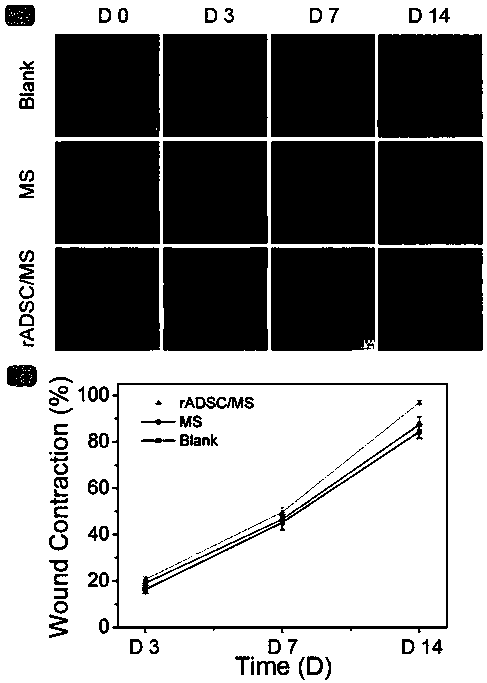 rADSCs loaded gelatin microspheres and preparation method and application thereof