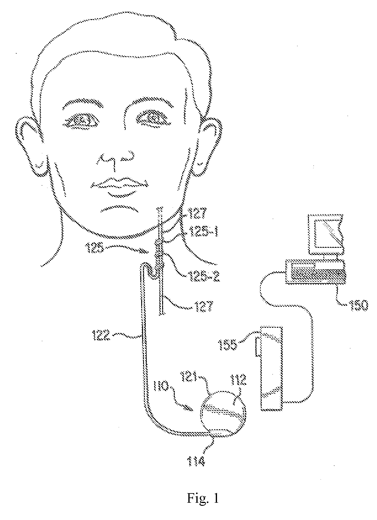 Implantable Medical Device Charge Balance Assessment