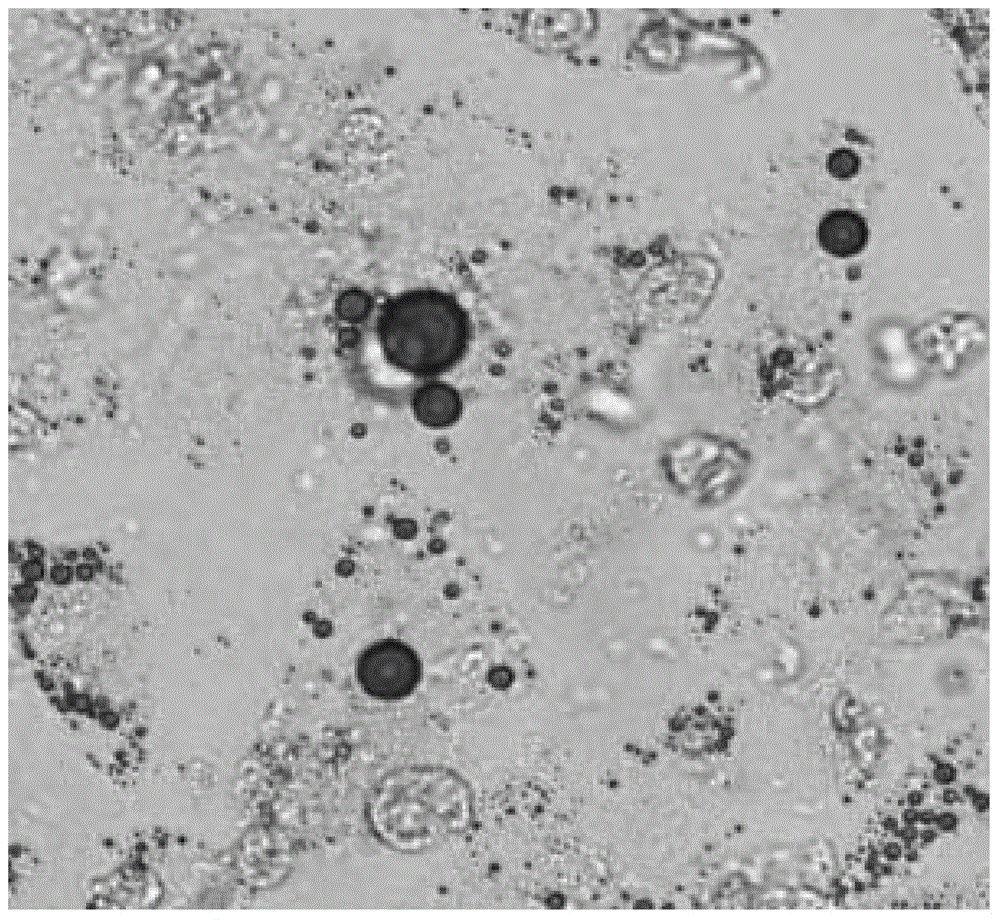 Fat mesenchymal progenitor cell and platelet-rich blood plasma composition for treatment of hepatitis B