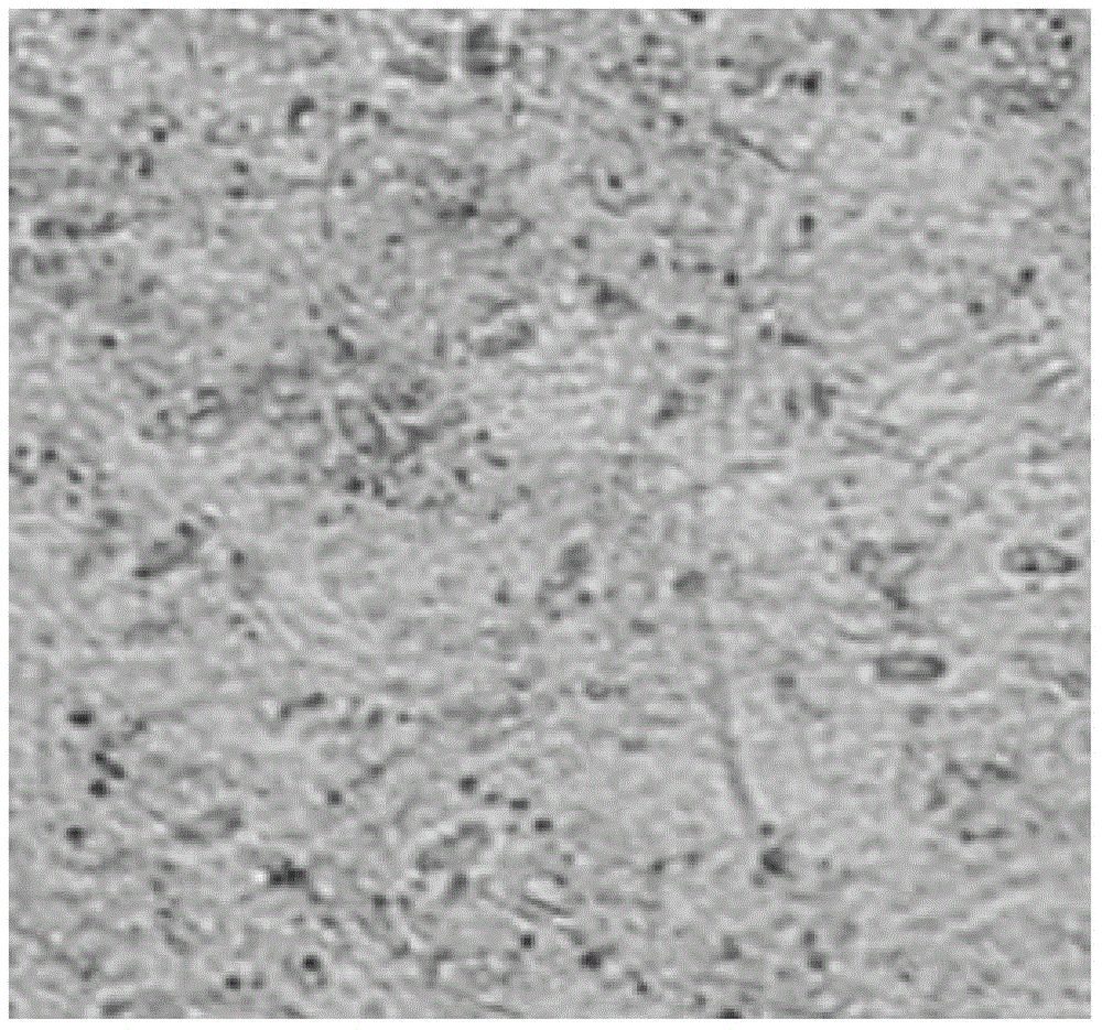 Fat mesenchymal progenitor cell and platelet-rich blood plasma composition for treatment of hepatitis B