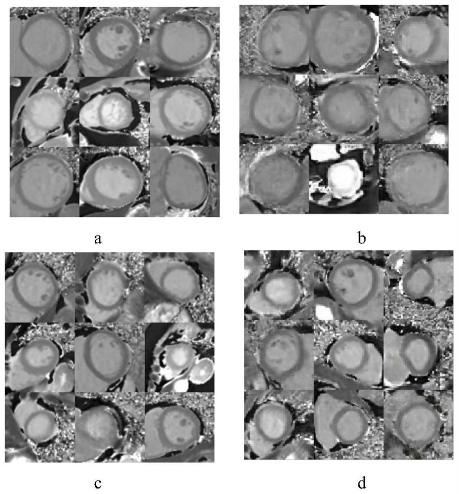 Heart magnetic resonance image data enhancement method based on evolutionary GAN