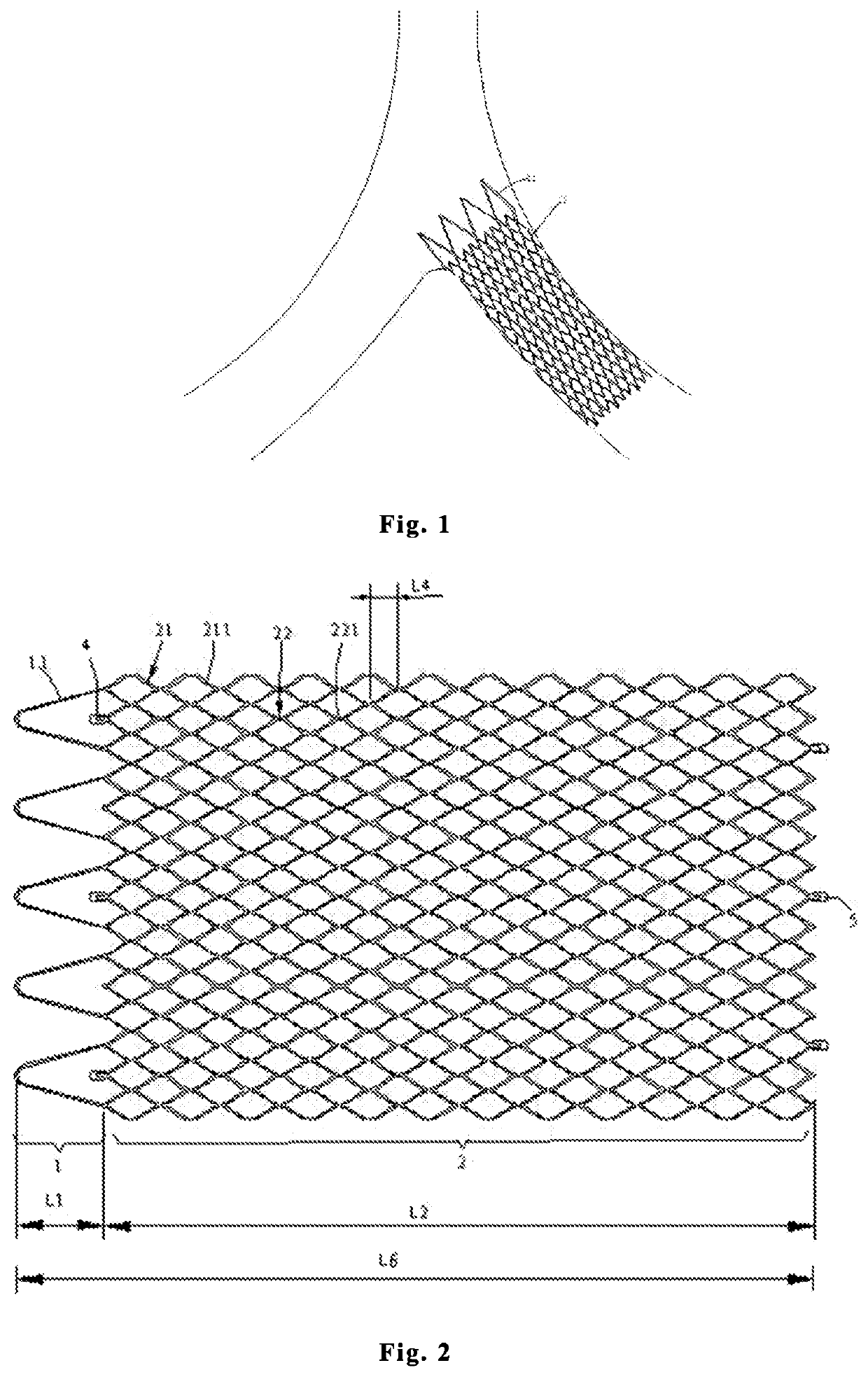 Intravascular stent, preparation method and use thereof