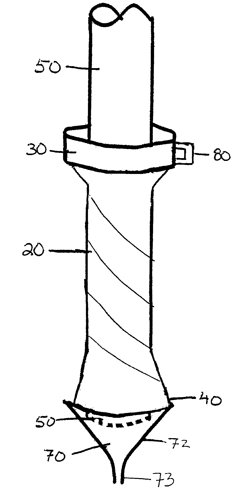 Umbilical cord cell harvesting