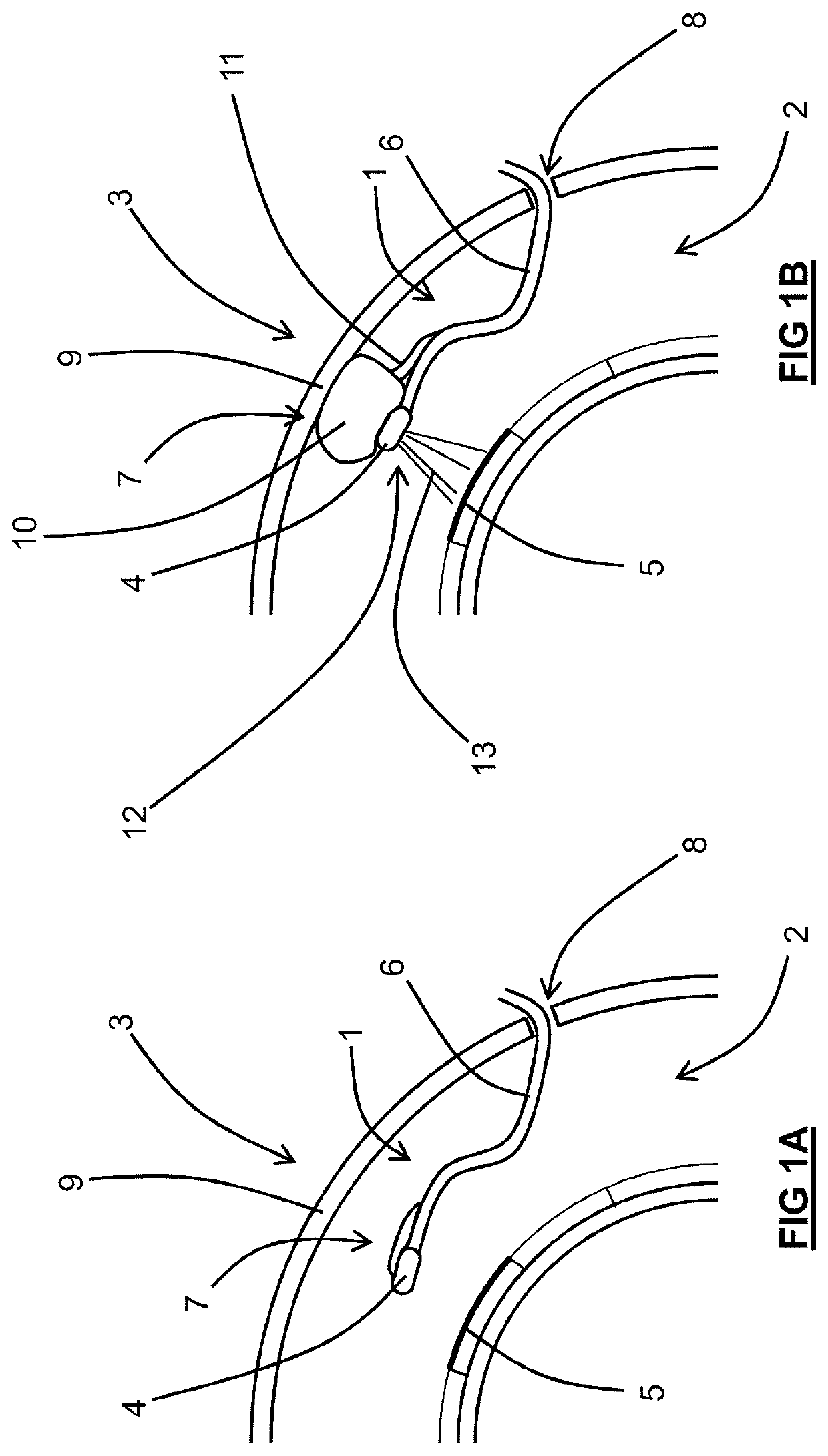 Positioning device