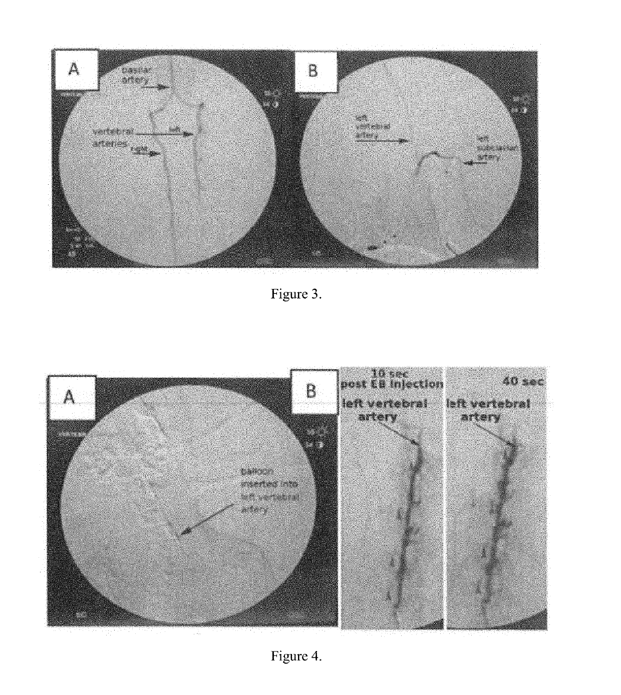 Non-invasive method for direct delivery of therapeutics to the spinal cord in the treatment of spinal cord pathology