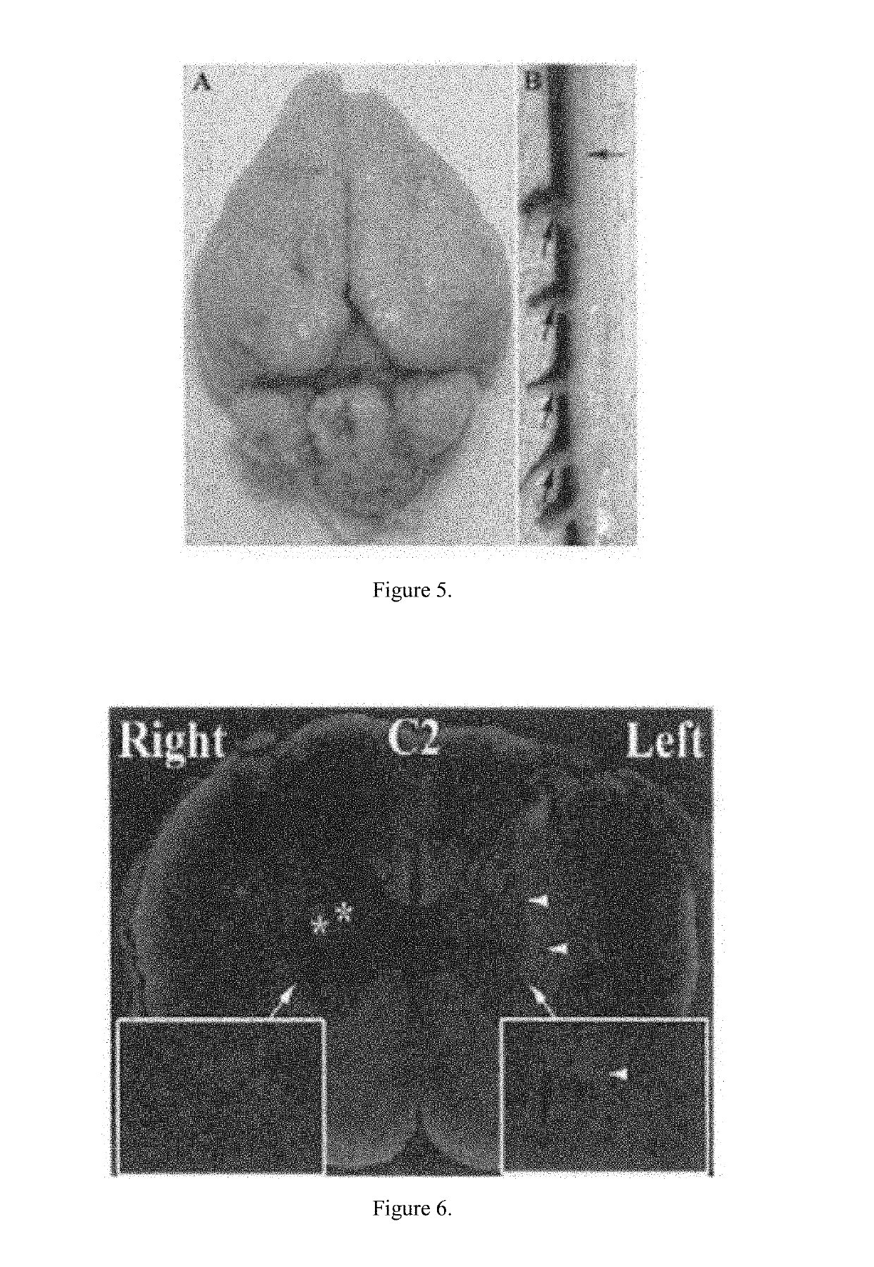 Non-invasive method for direct delivery of therapeutics to the spinal cord in the treatment of spinal cord pathology