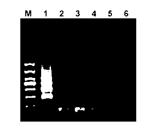 LAMP detection kit for macrobrachium rosenbergii nudivirus and detection method thereof