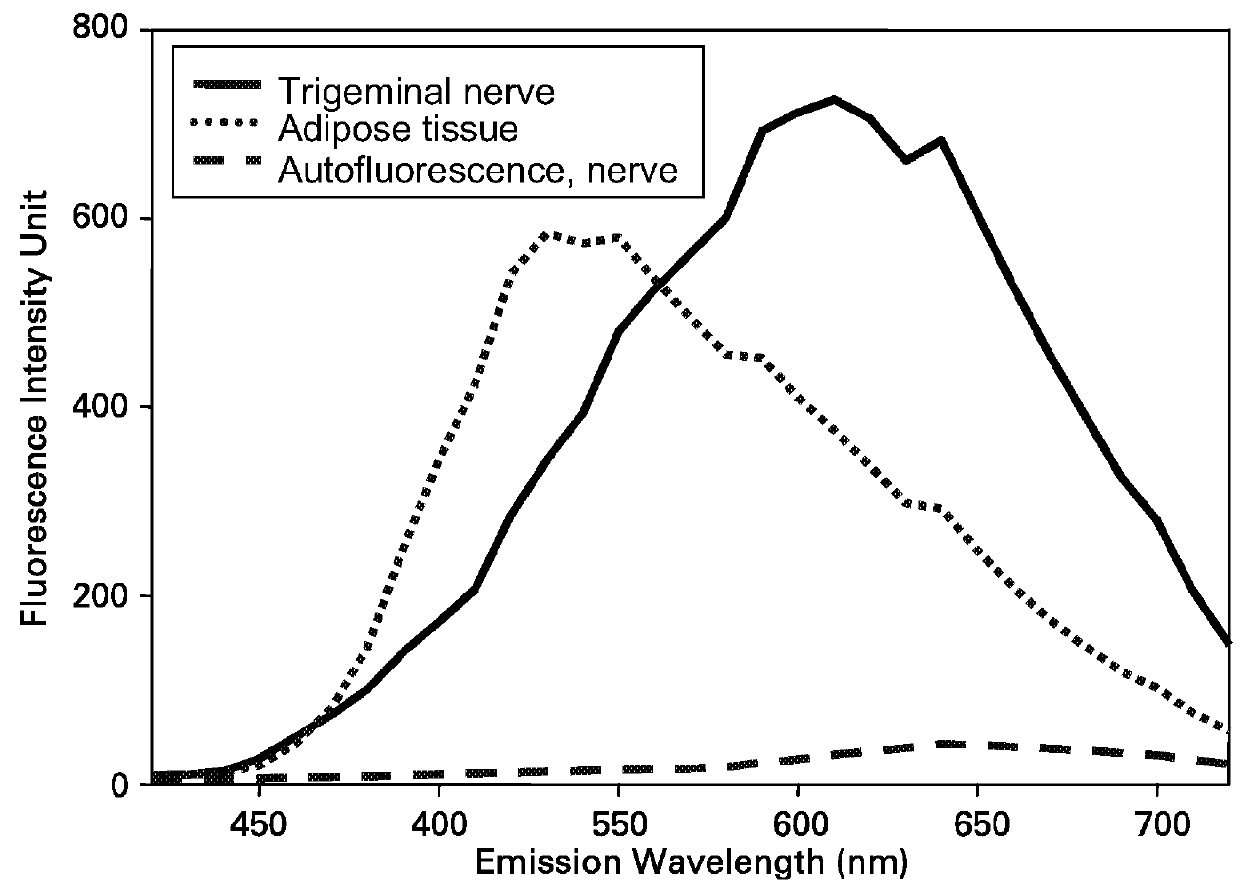 Systems for intraoperative nerve imaging