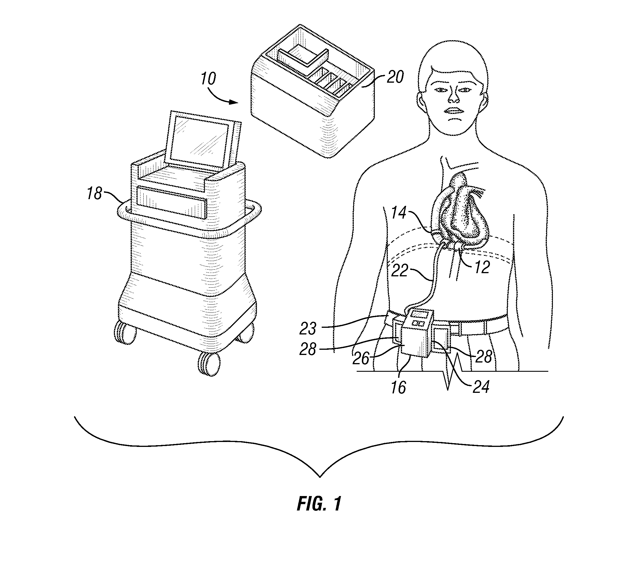 Blood pump system