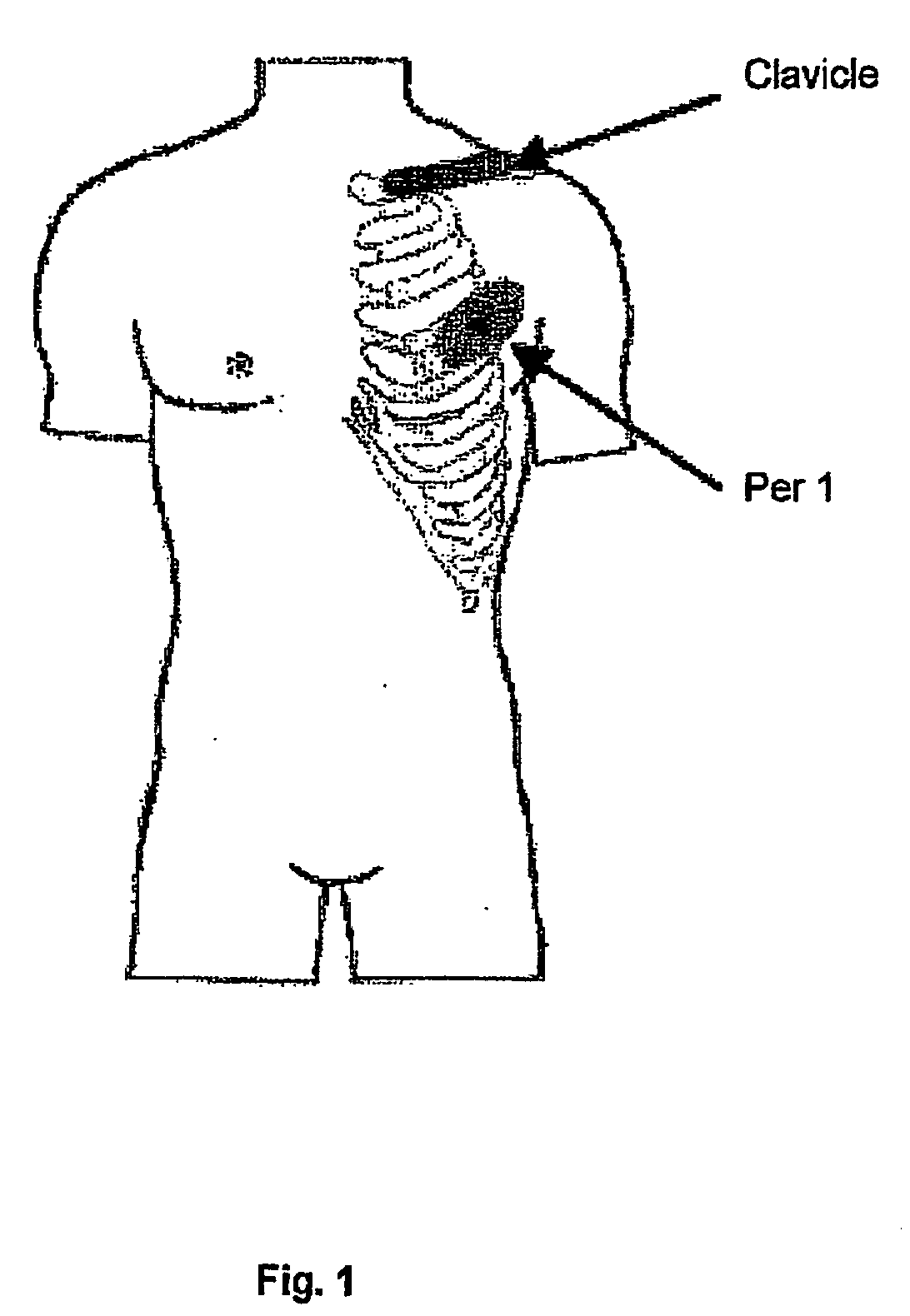 Evaluation of Sympathetic Tone