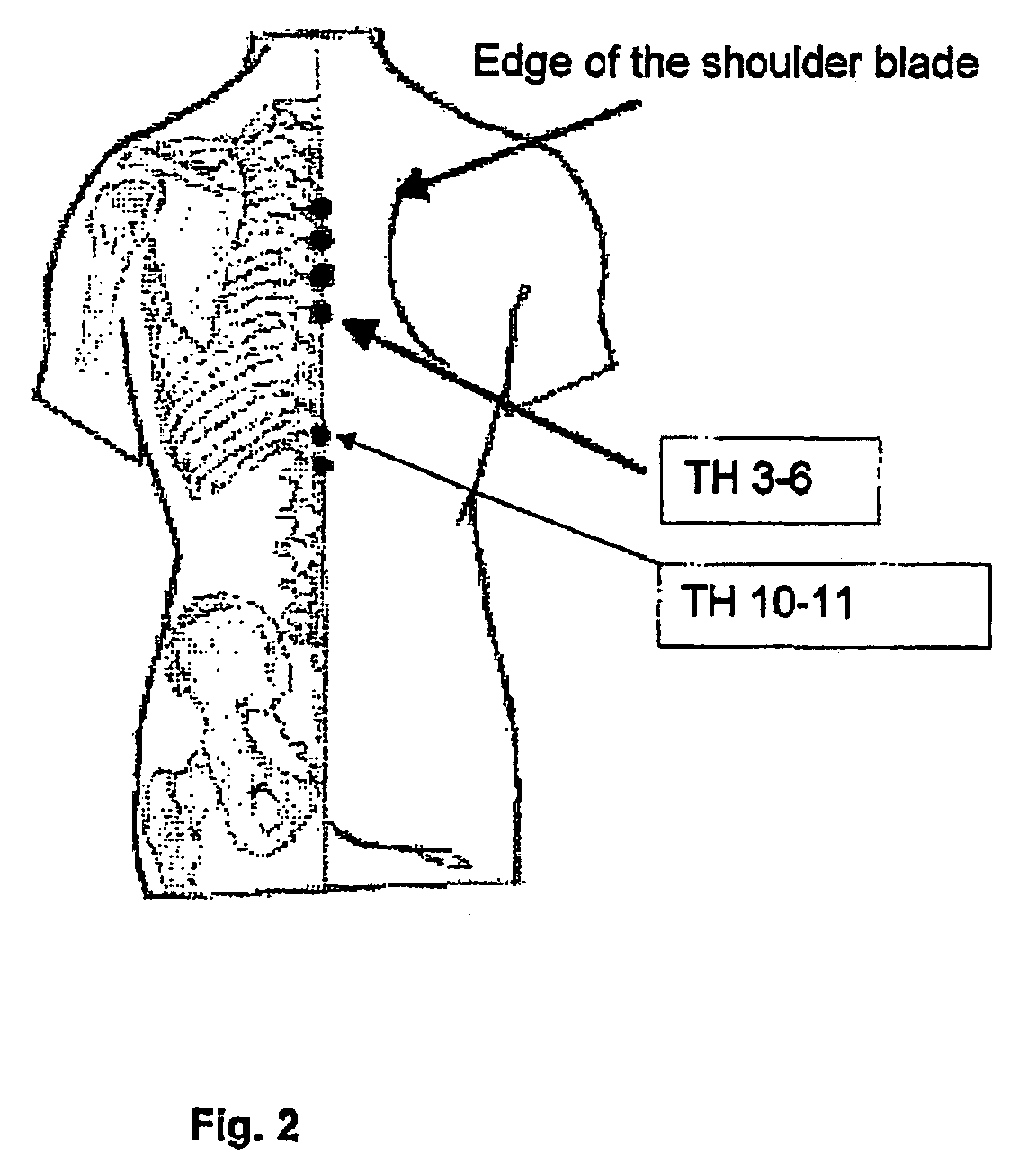 Evaluation of Sympathetic Tone