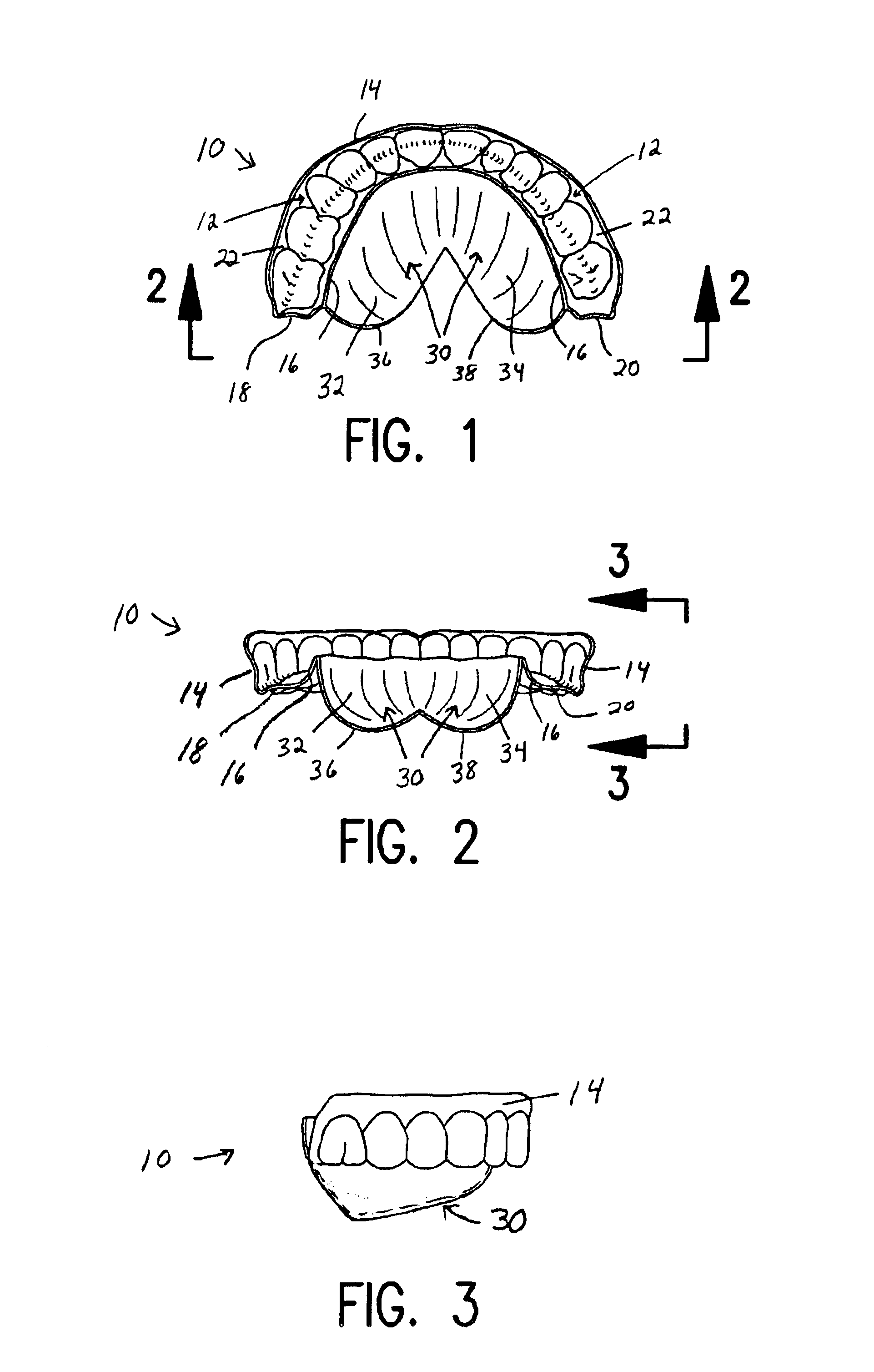 Tongue-airway appliance