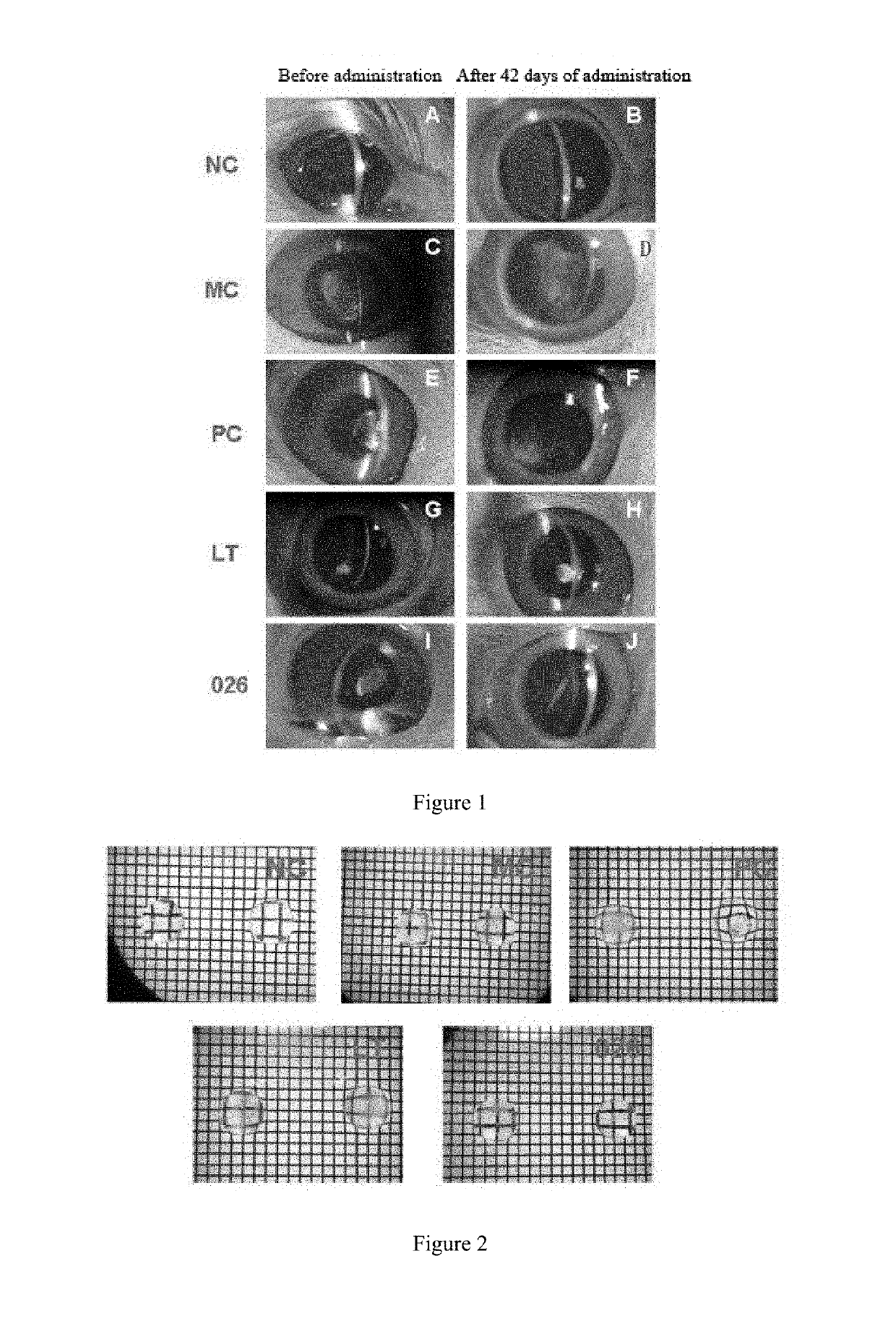 Lanosterol prodrug compound and preparation method therefor and use thereof