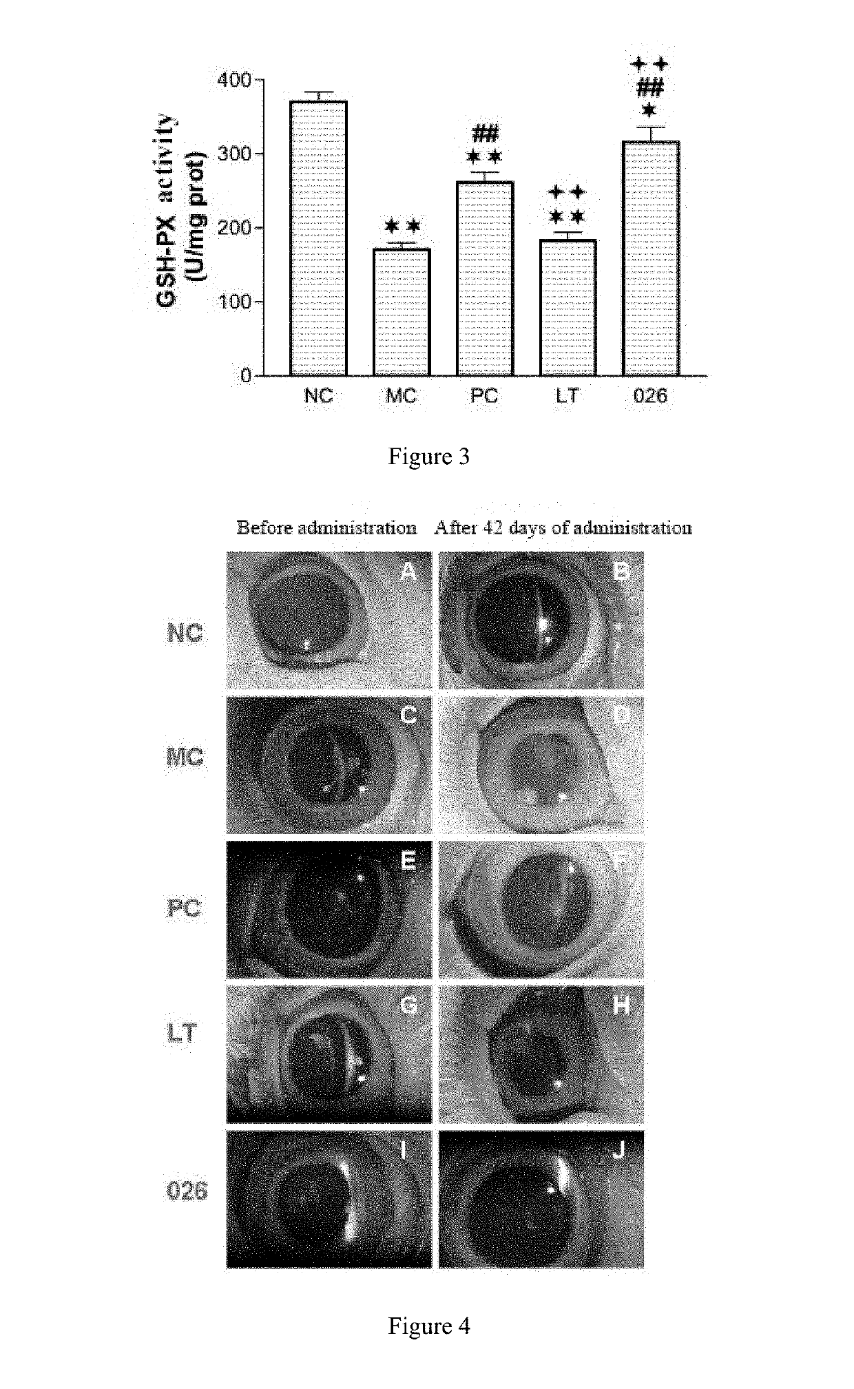 Lanosterol prodrug compound and preparation method therefor and use thereof