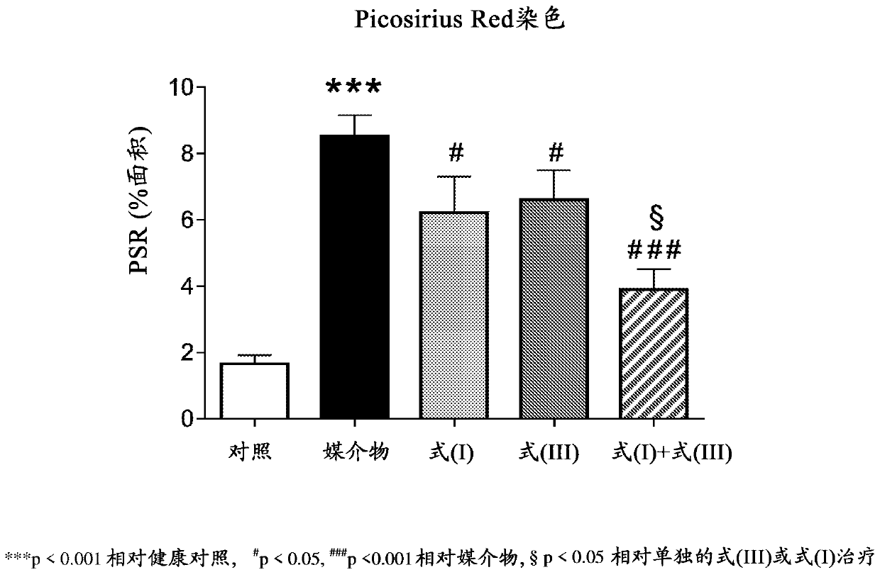 Methods of treating liver disease