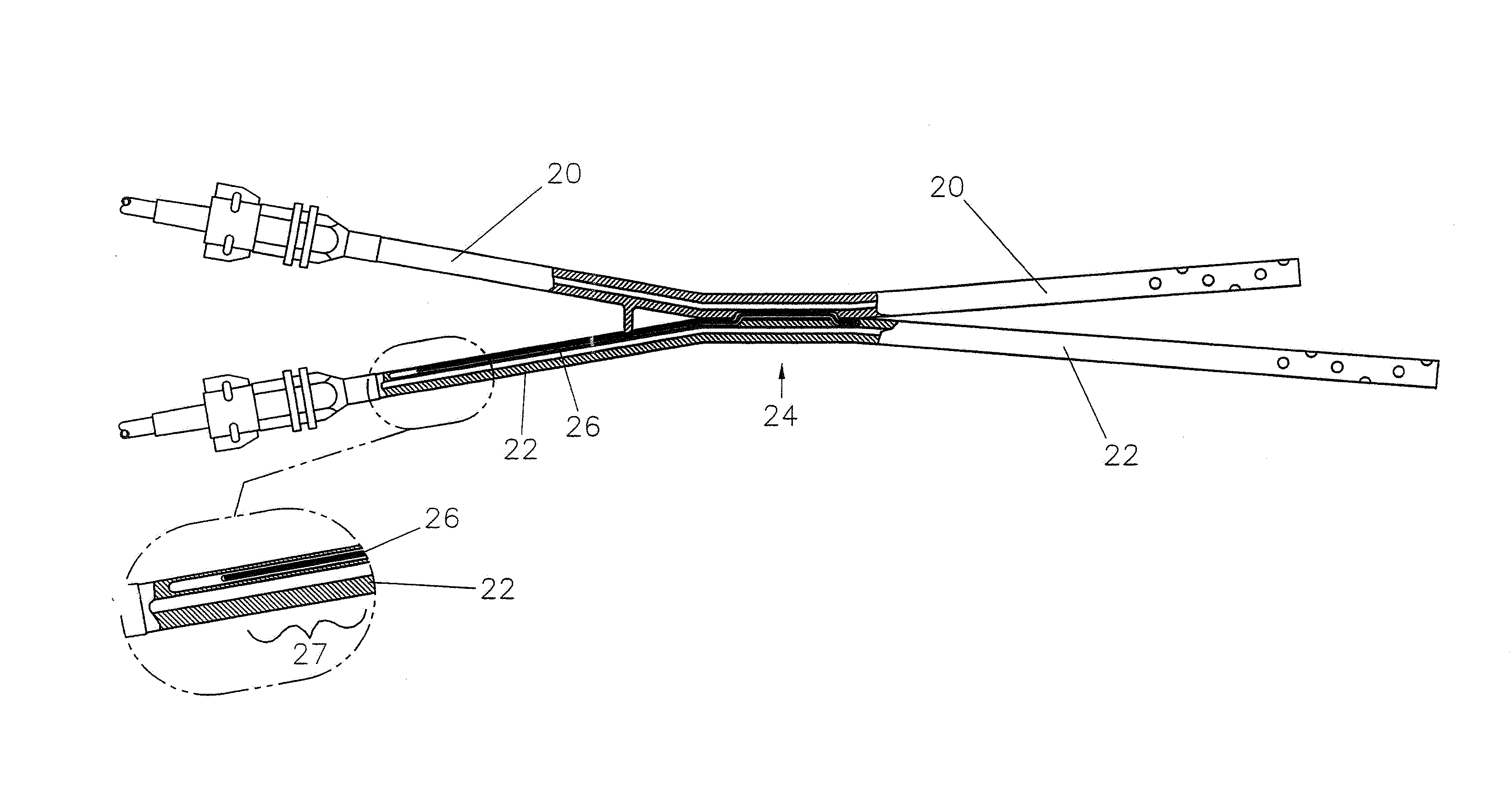 Catheter retention