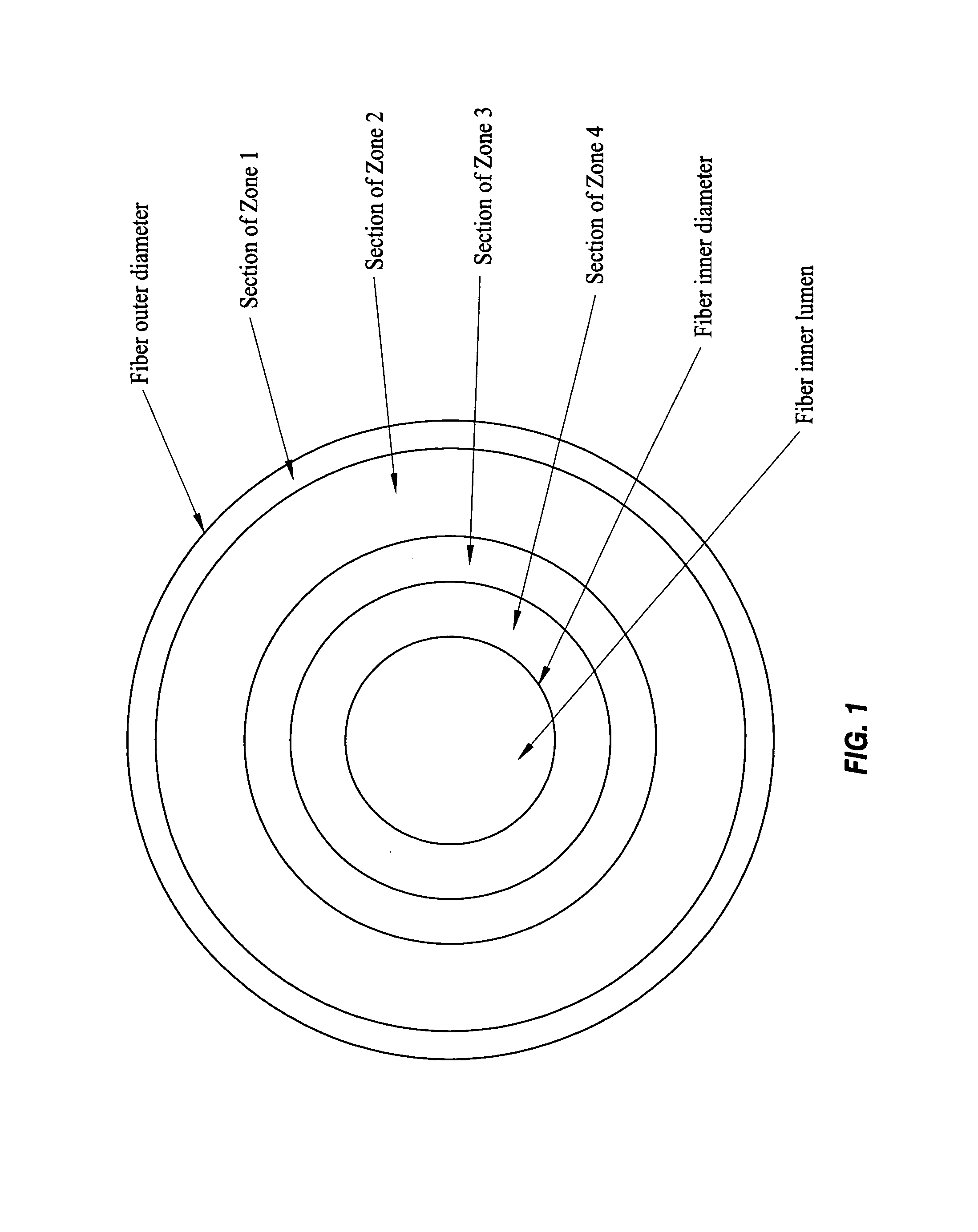 Specialized hollow fiber membranes for in-vivo plasmapheresis and ultrafiltration