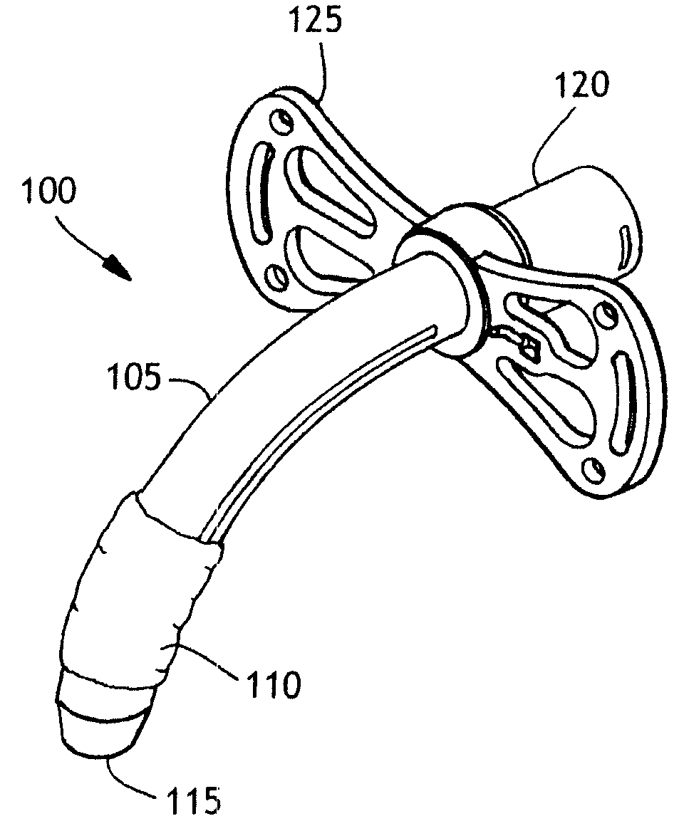 Balloon cuff tracheostomy tube