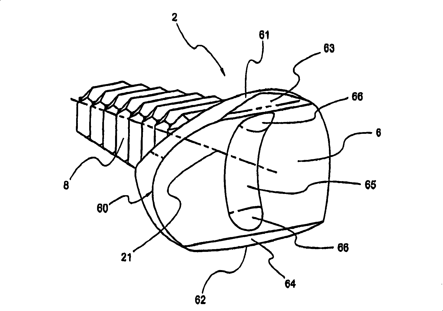 Prosthetic device for total joint replacement in small joint arthroplasty