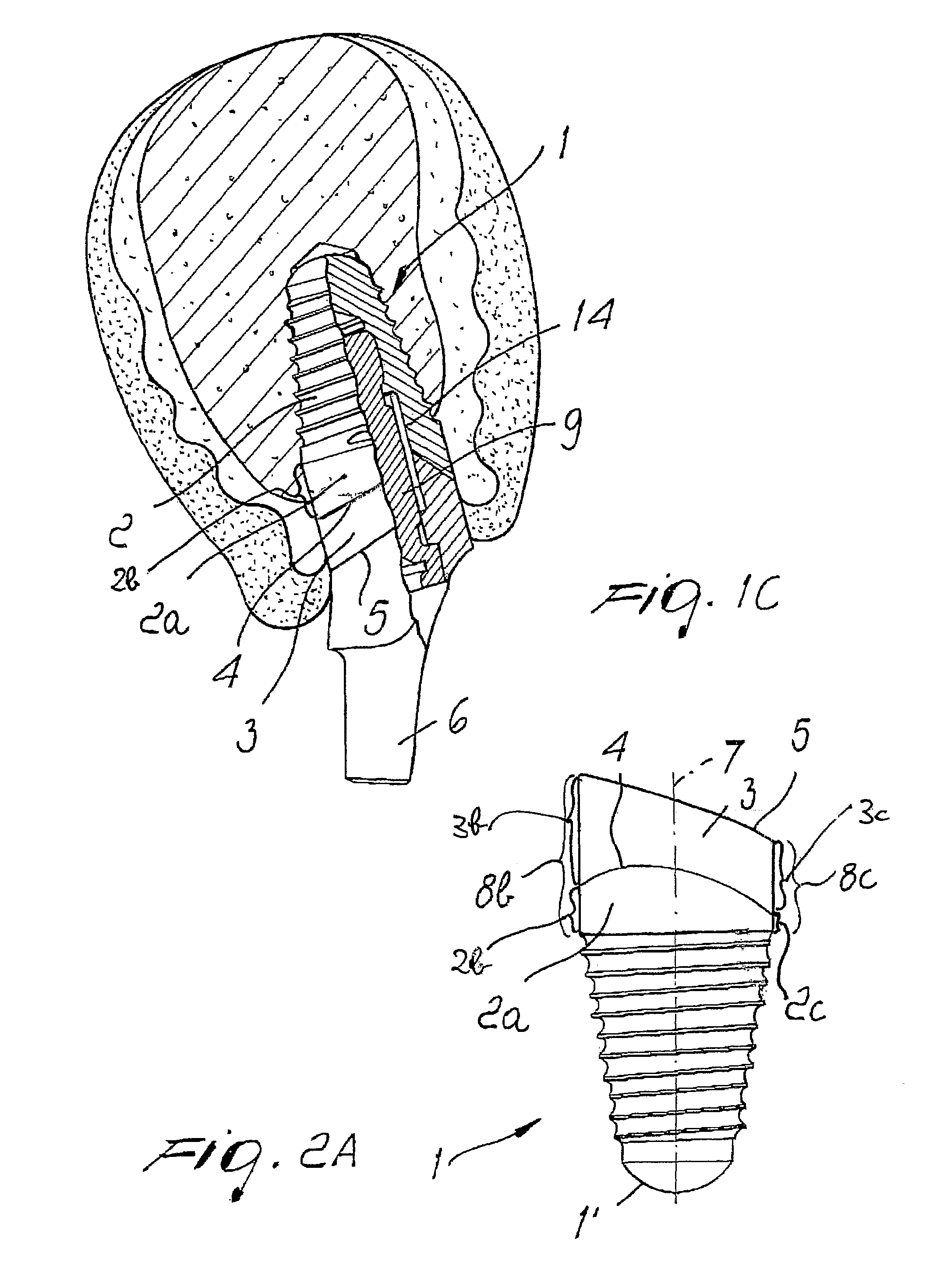 Dental implant with positioning means