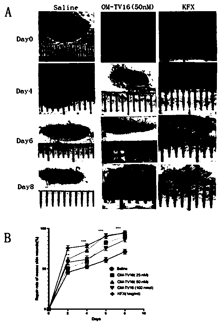 Skin protection peptide OM-TV16, and preparation method and application thereof