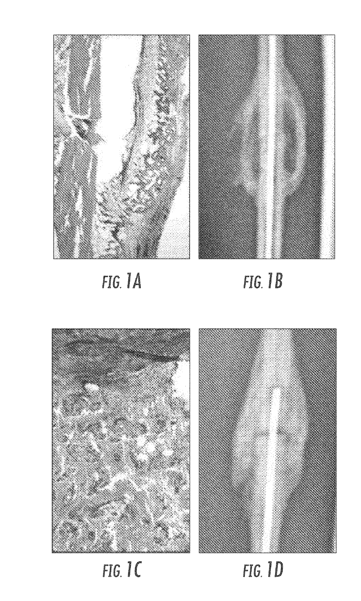 Matrix for enhanced delivery of osteoinductive molecules in bone repair