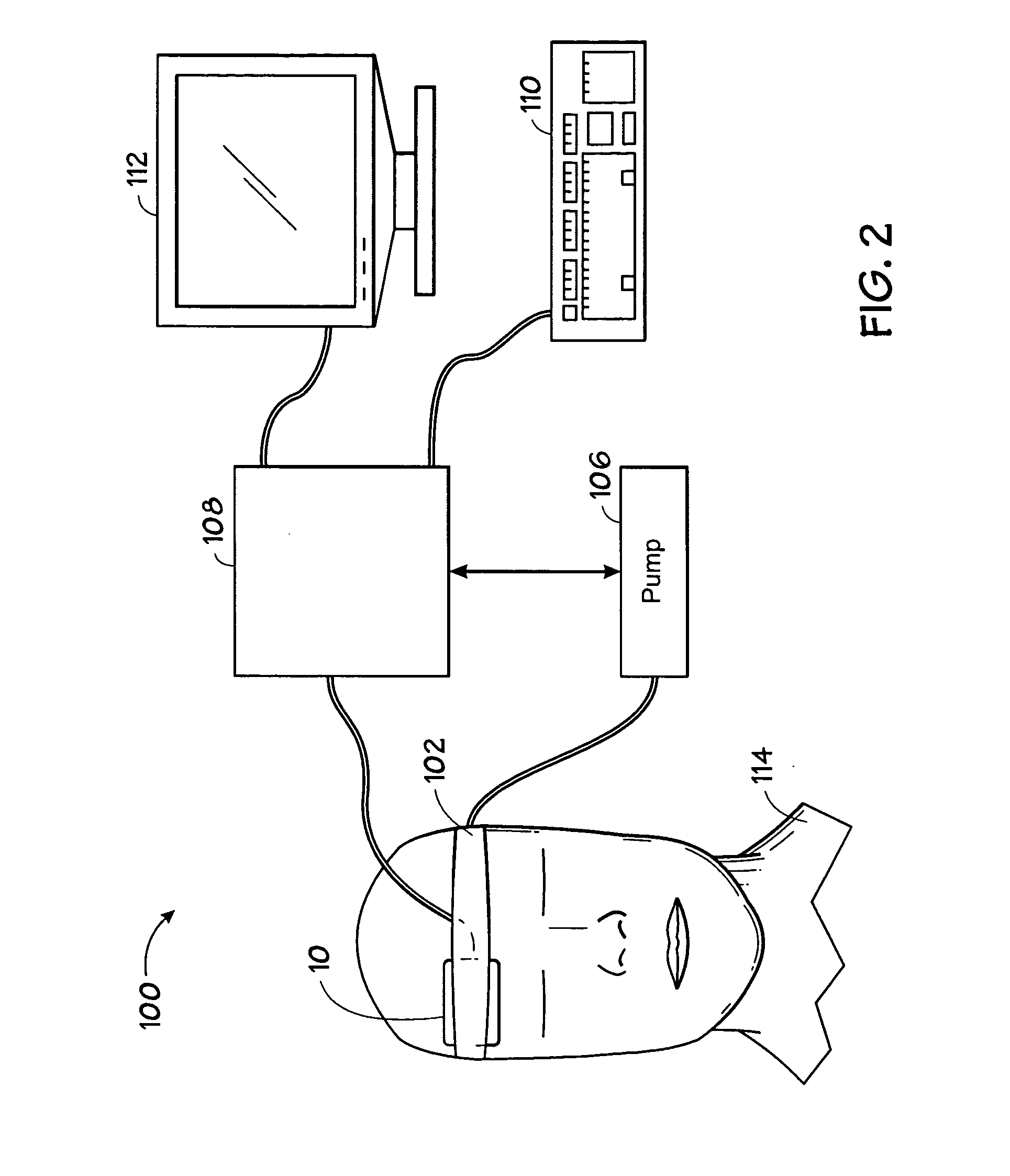 Method and system for monitoring intracranial pressure