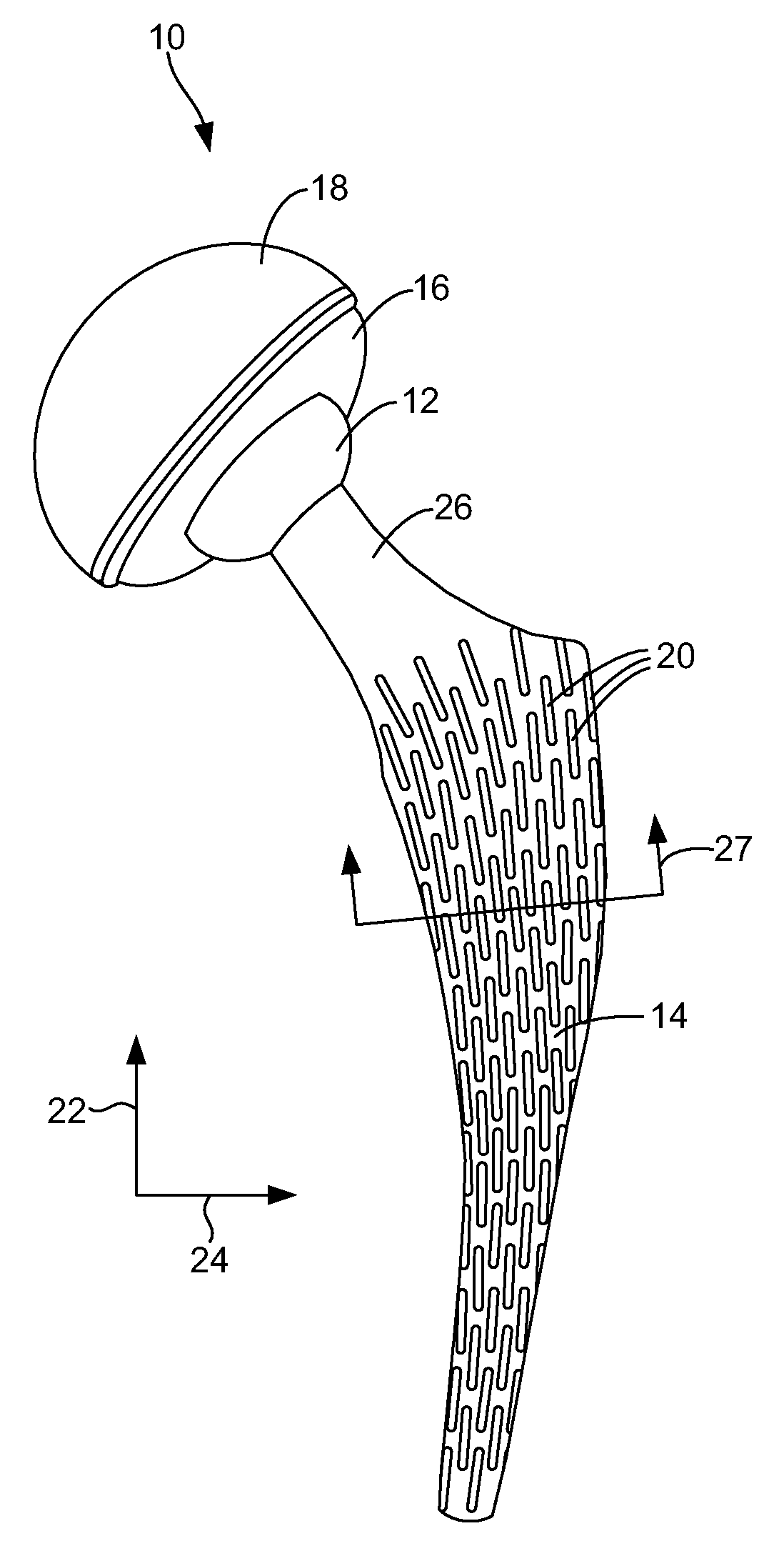 Porous, load-bearing, ceramic or metal implant