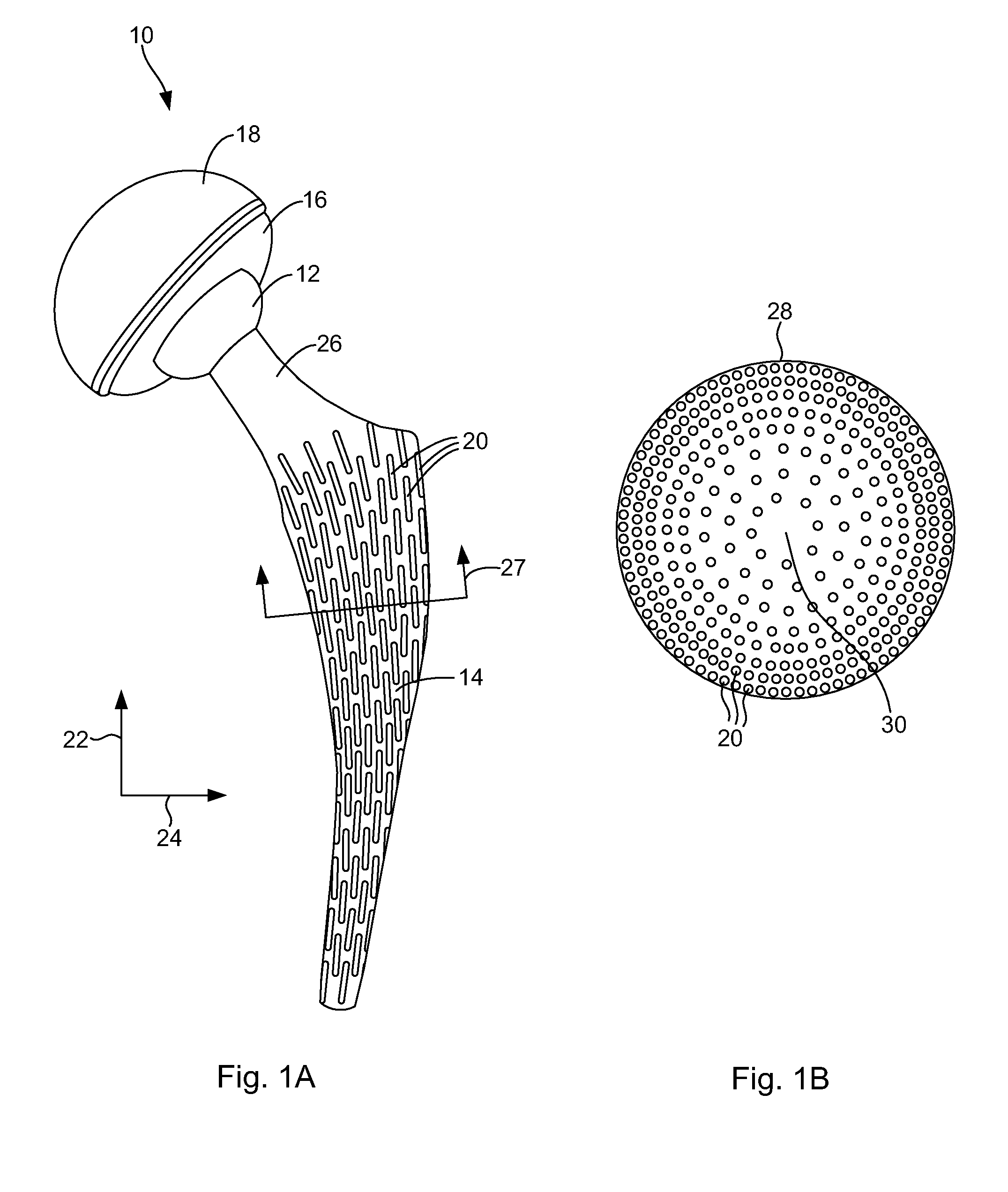 Porous, load-bearing, ceramic or metal implant